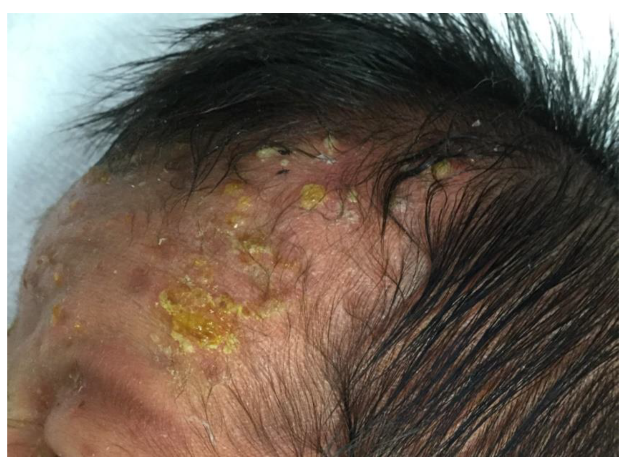 Children 08 00030 g002