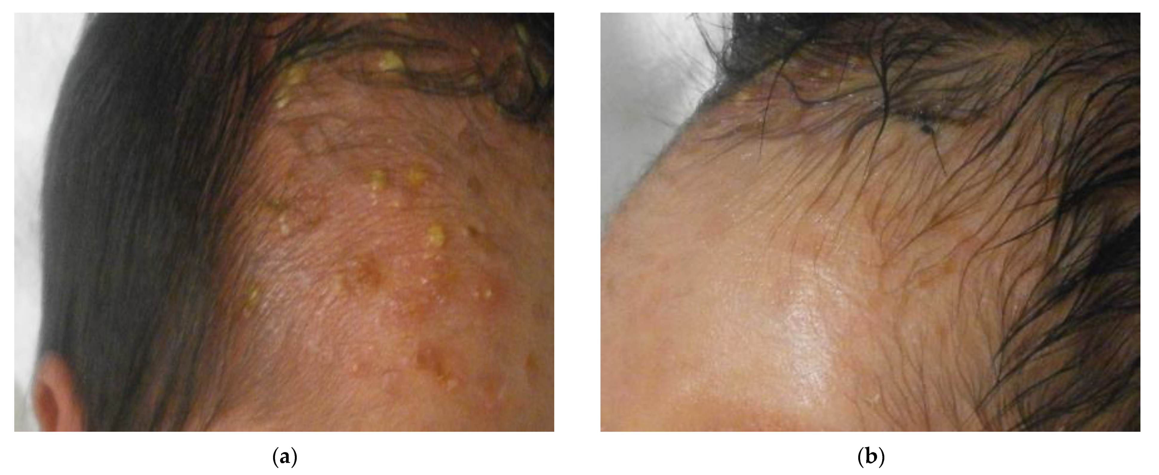 Children 08 00030 g004