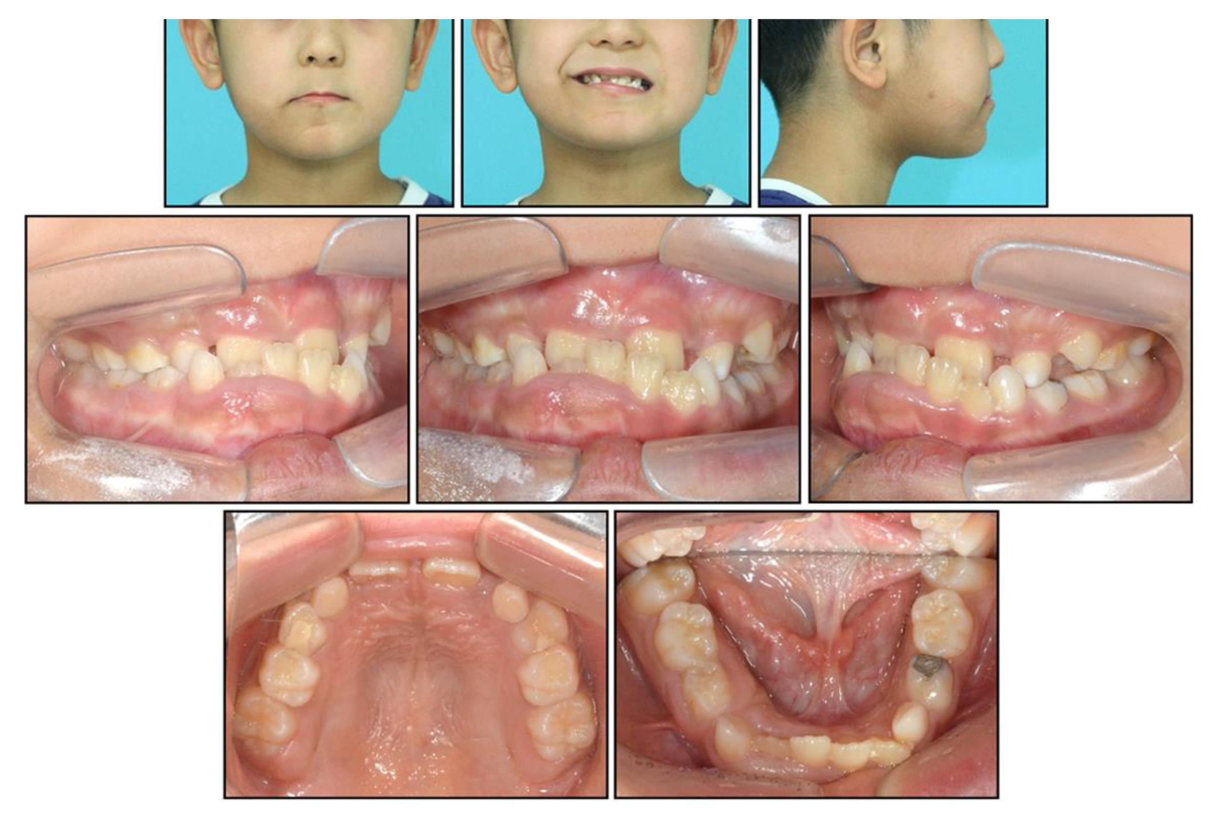 Children 08 00072 g001