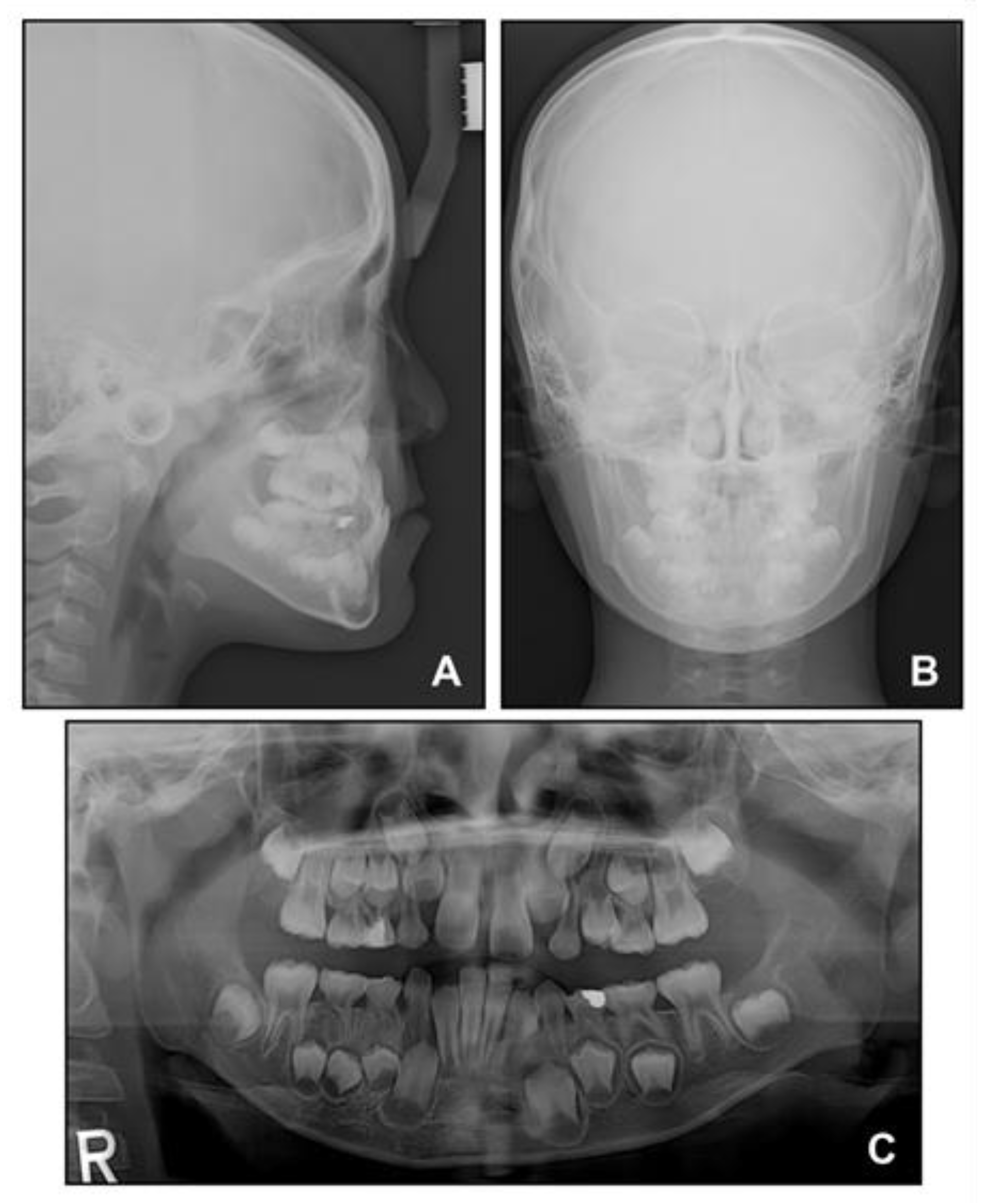 Children 08 00072 g003