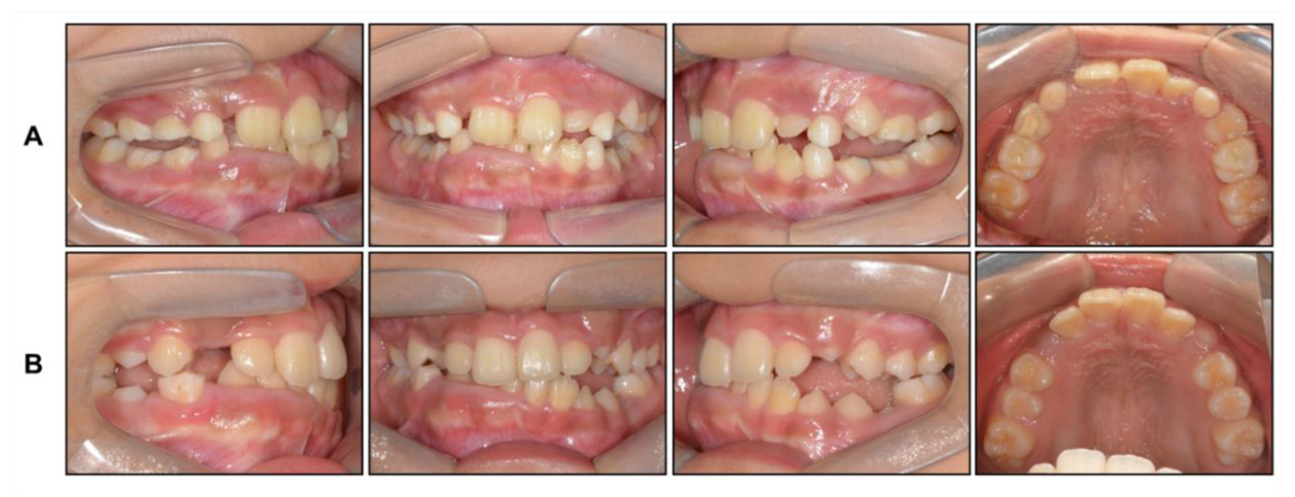 Children 08 00072 g004