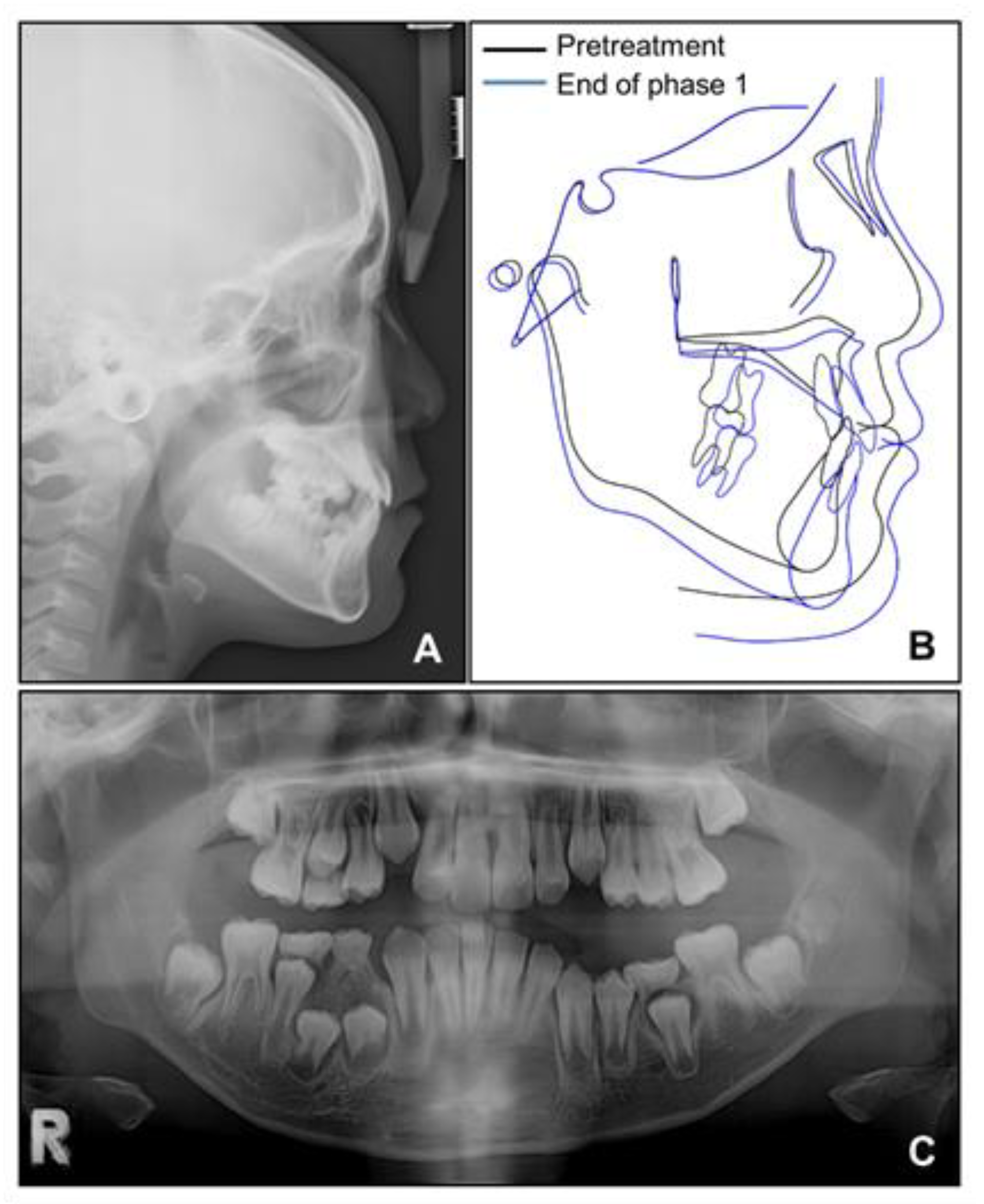 Children 08 00072 g005
