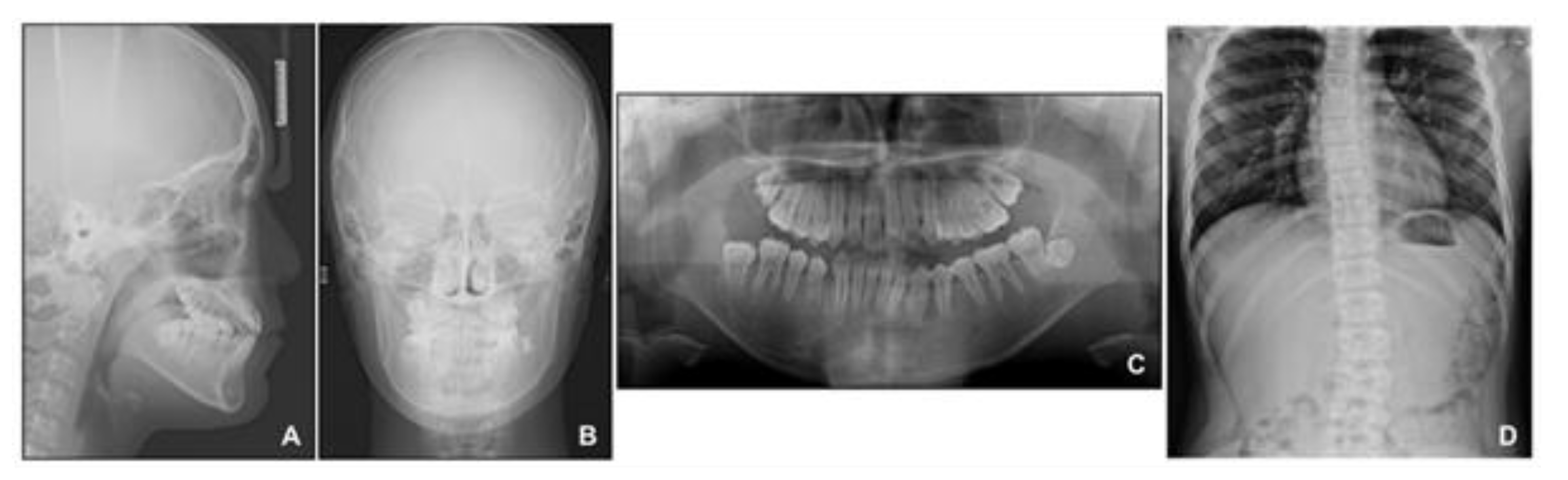 Children 08 00072 g008