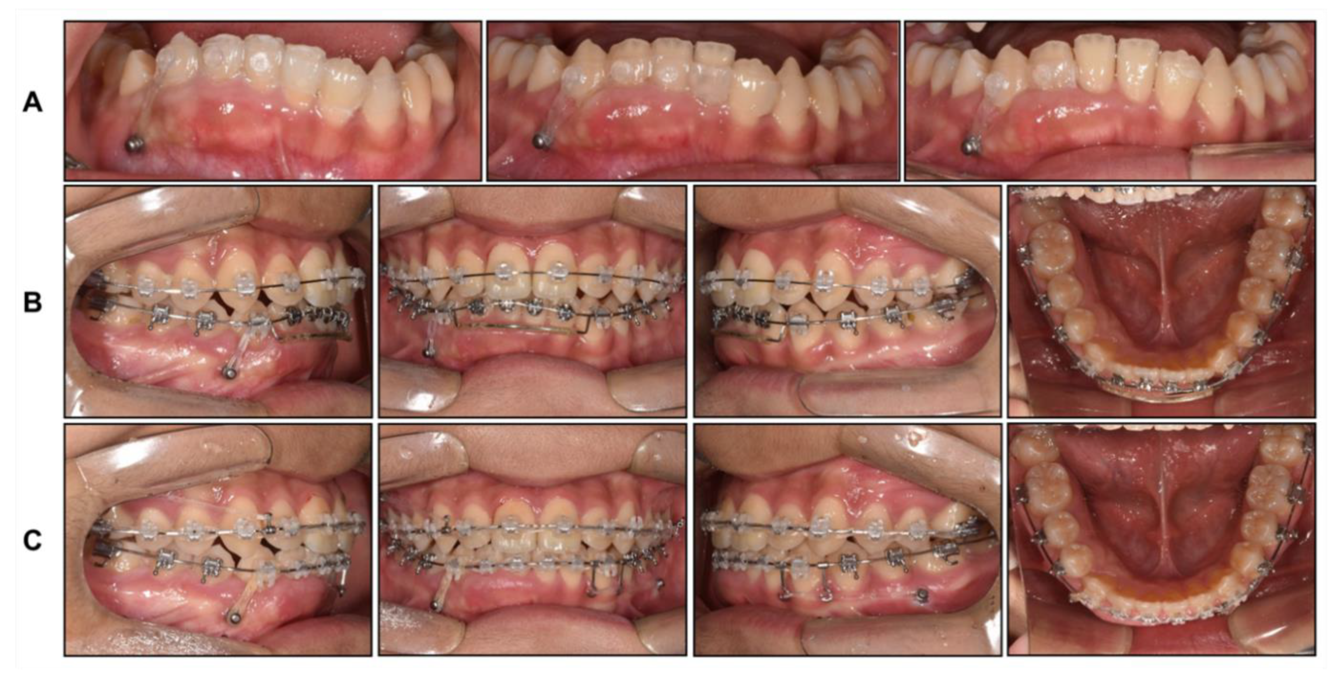 Children 08 00072 g009