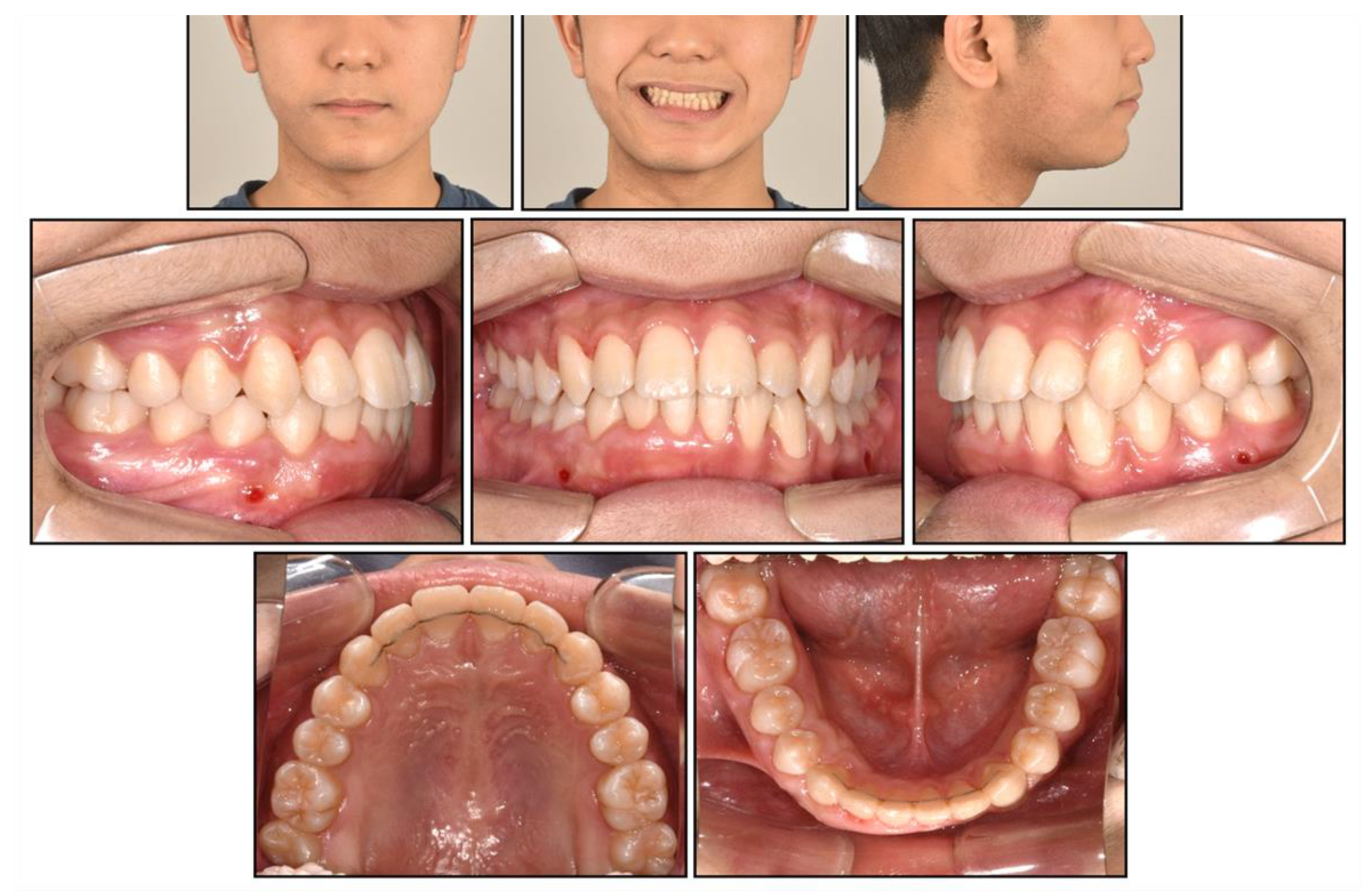 Children 08 00072 g010