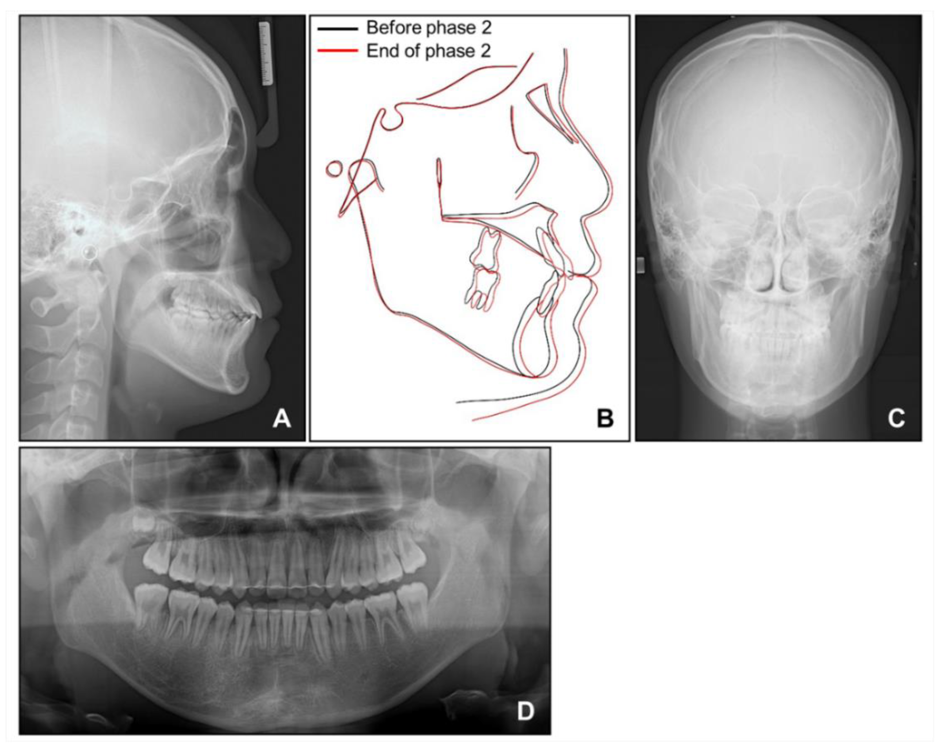 Children 08 00072 g012