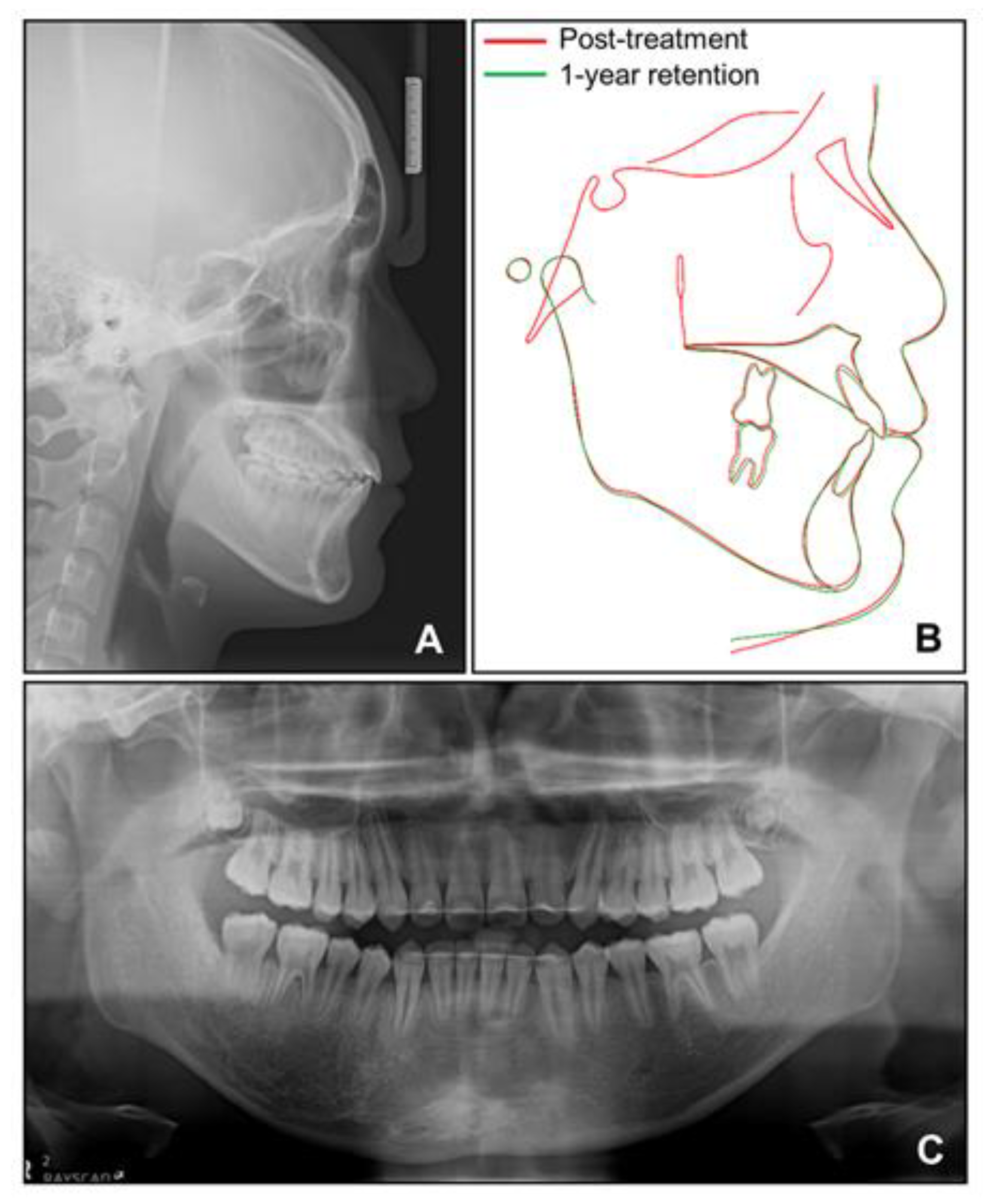 Children 08 00072 g014
