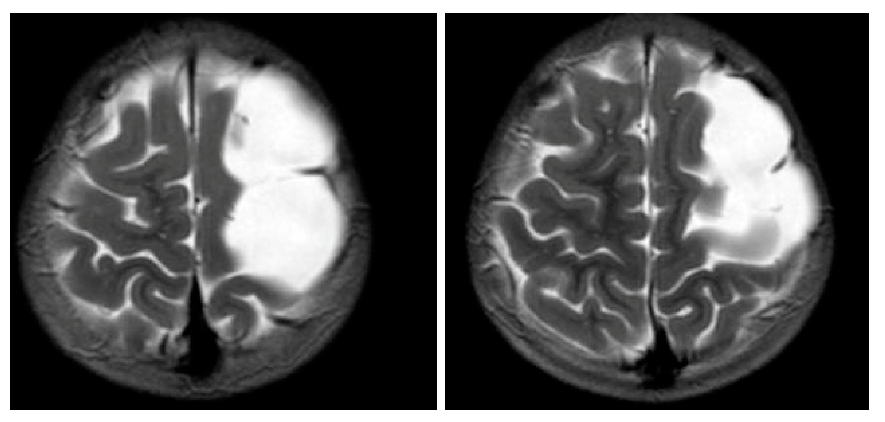 Children 08 00078 g004