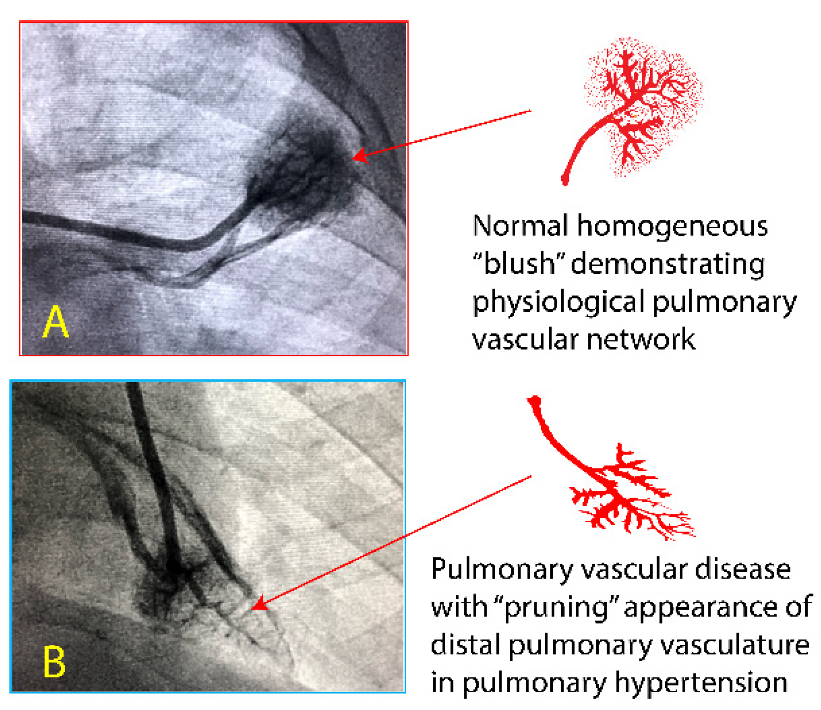 Children 08 00131 g003