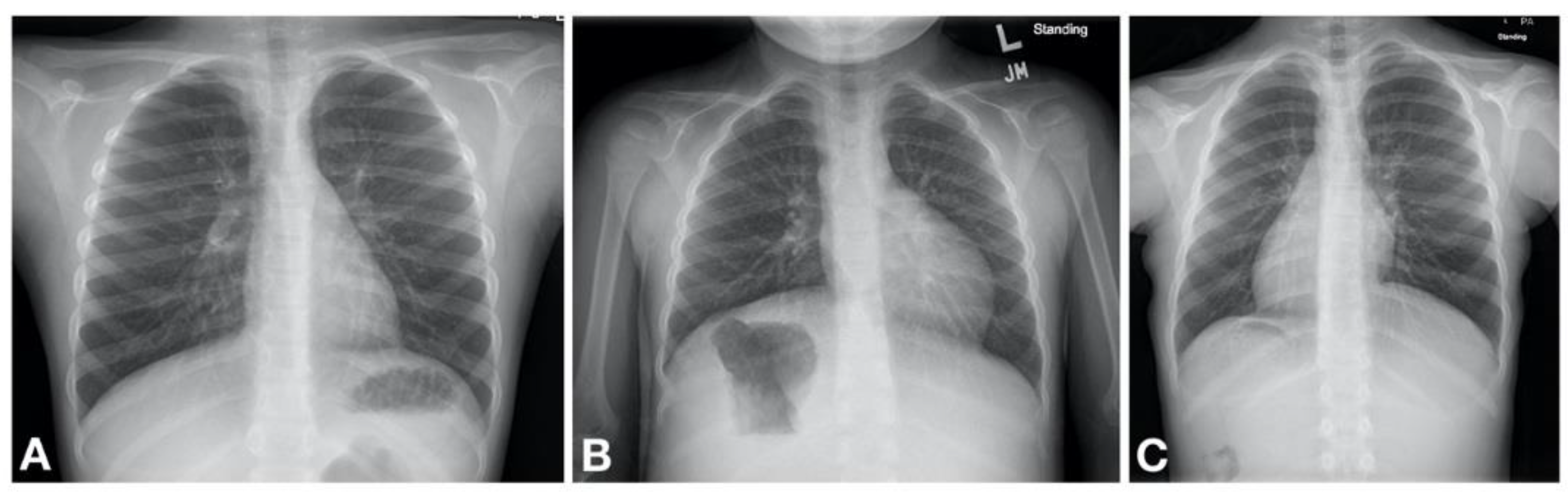 Children 08 00153 g002