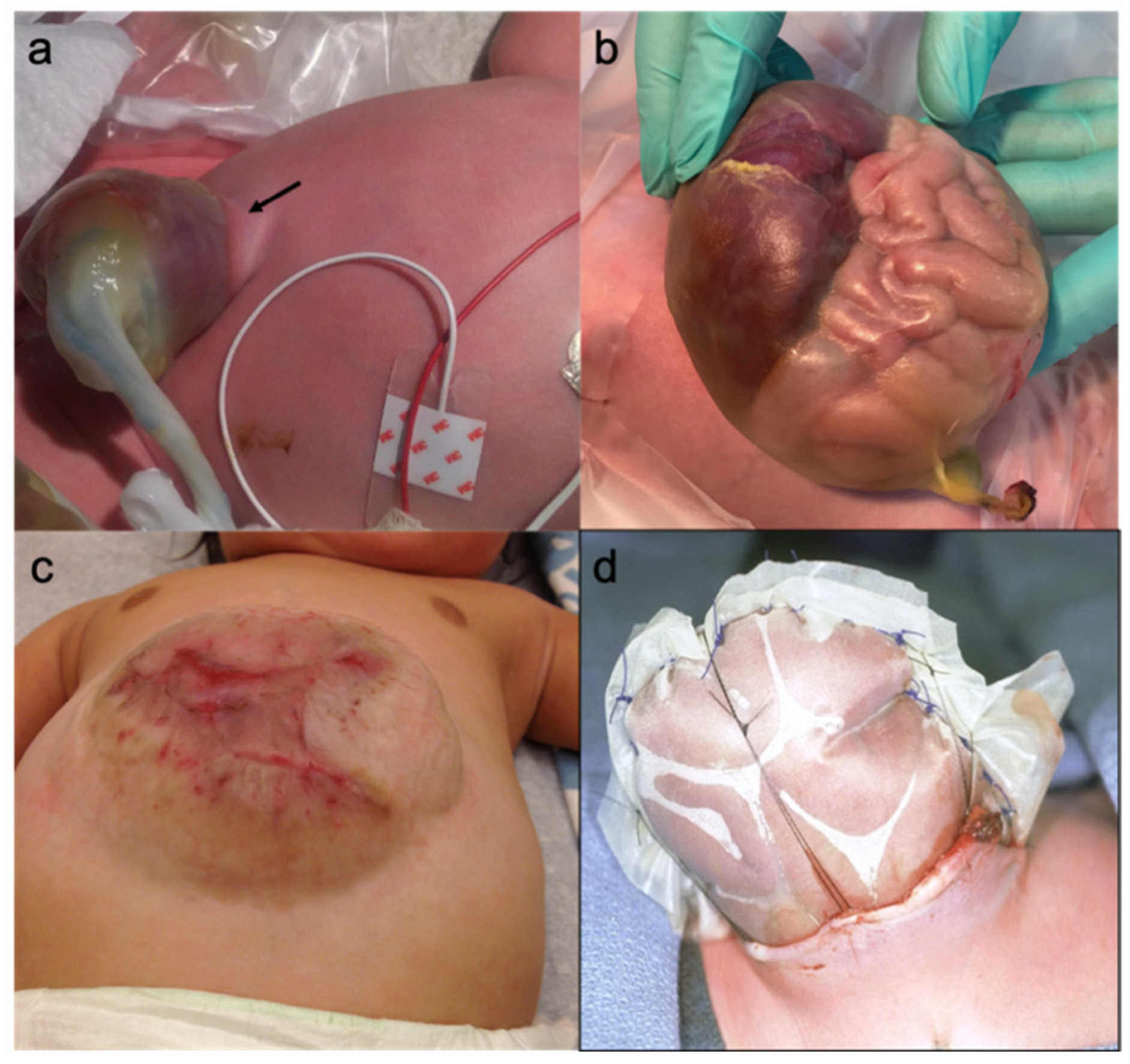 Children 08 00170 g002