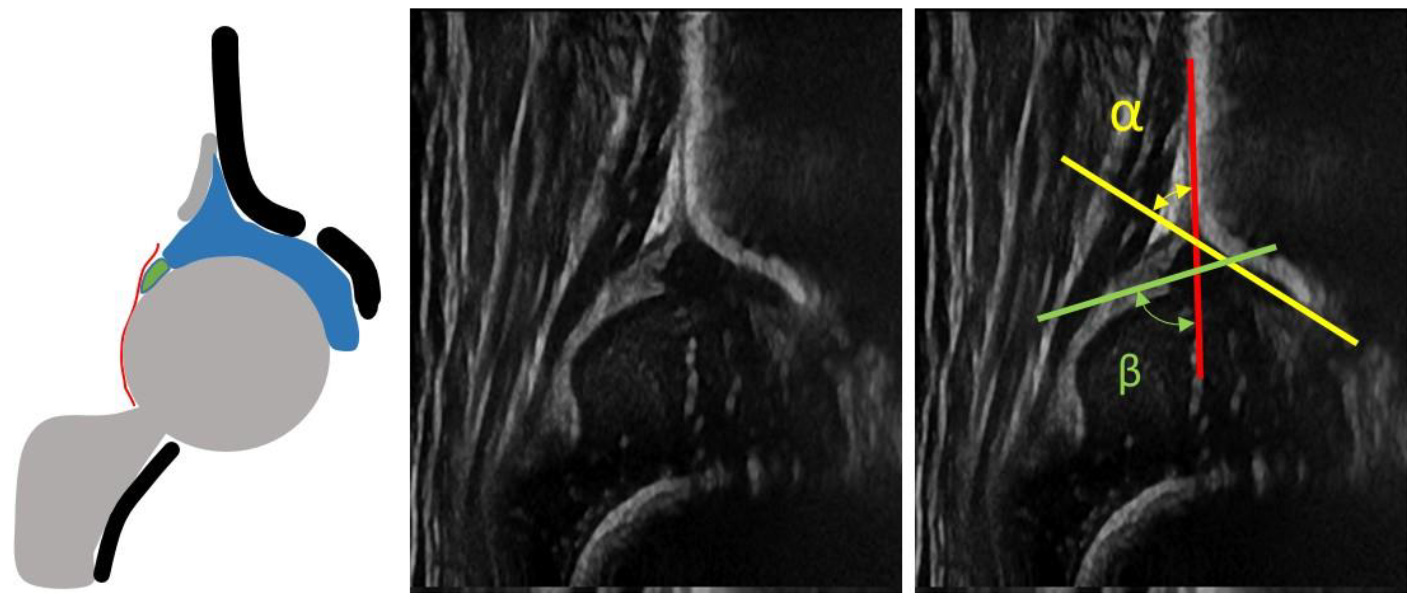 Children 08 00179 g005 Children 08 00179 g005