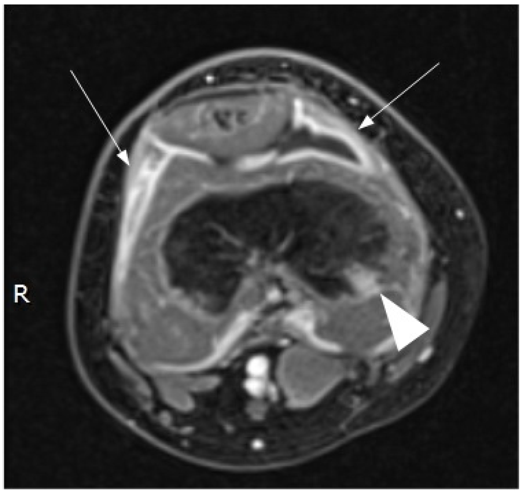 Children 08 00189 g002