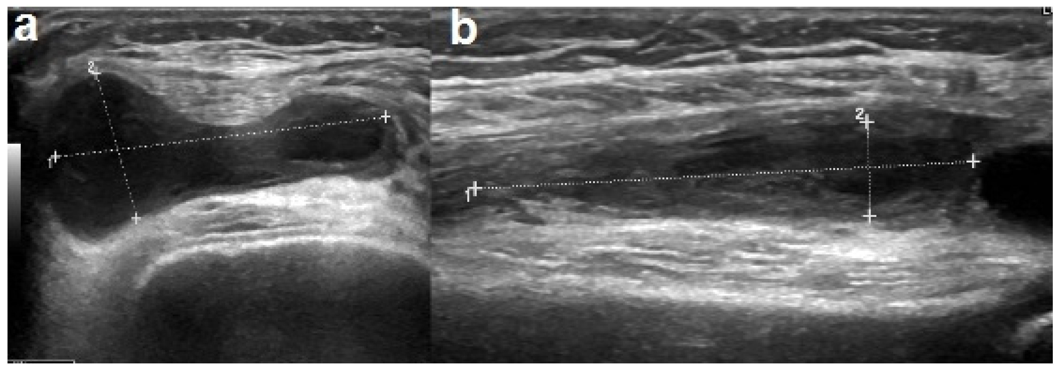 Children 08 00189 g003