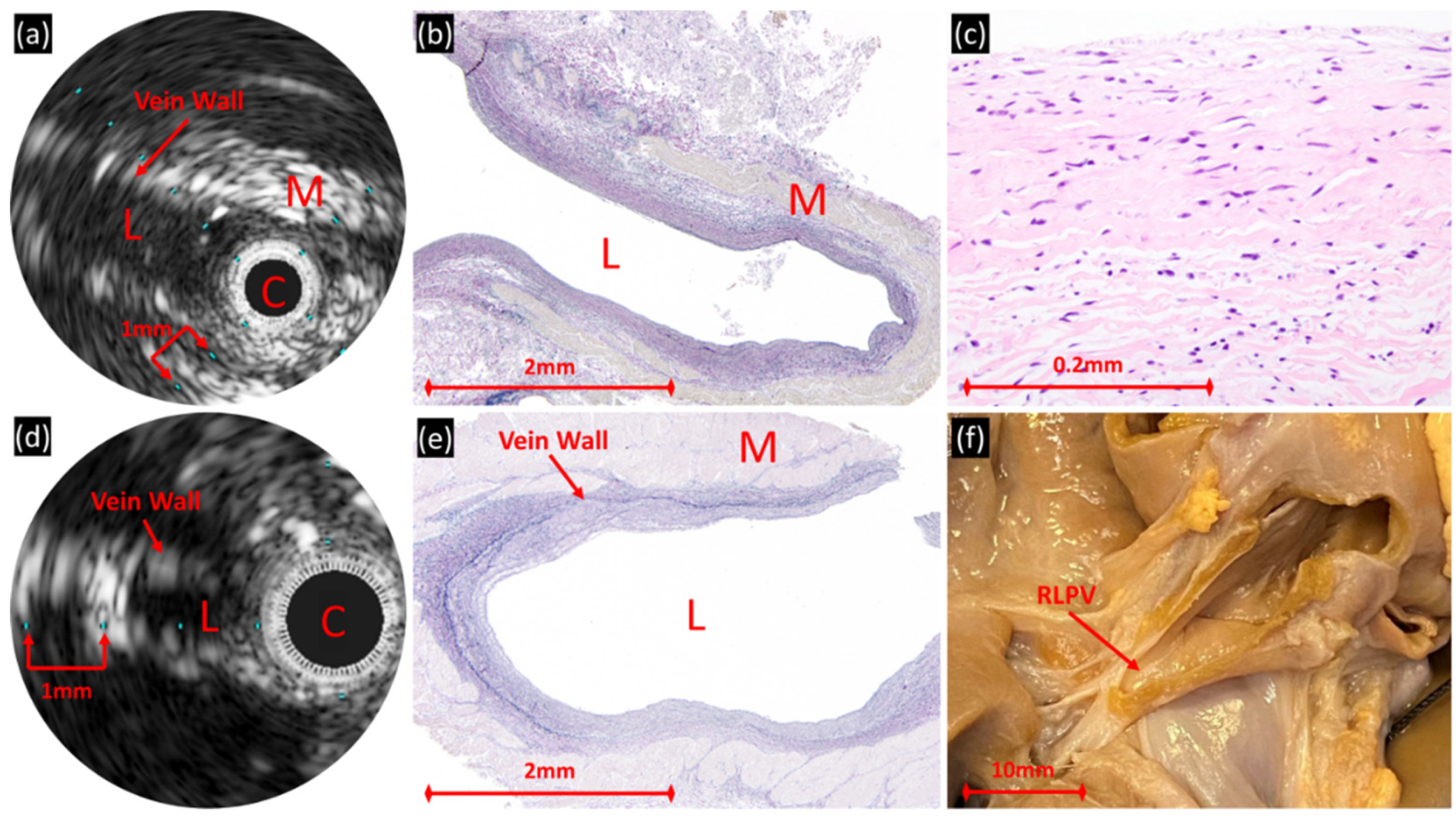 Children 08 00193 g004