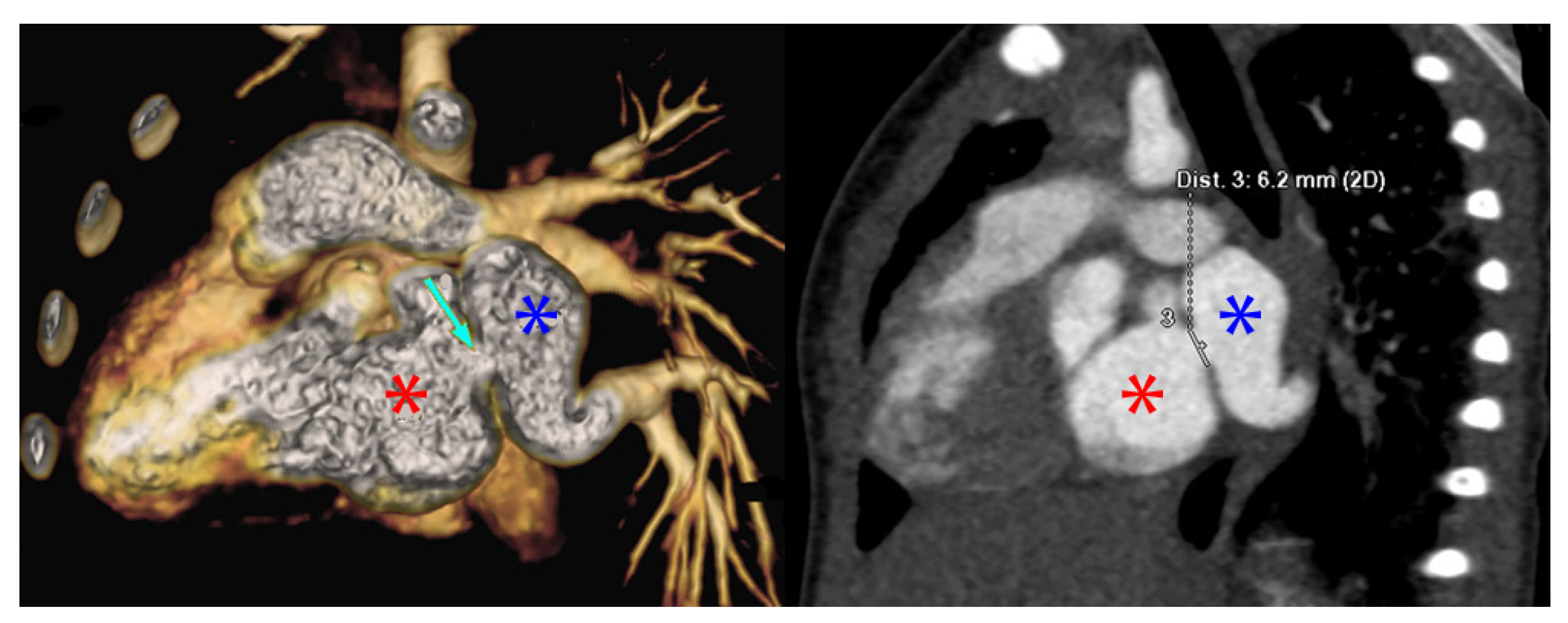 Children 08 00198 g002