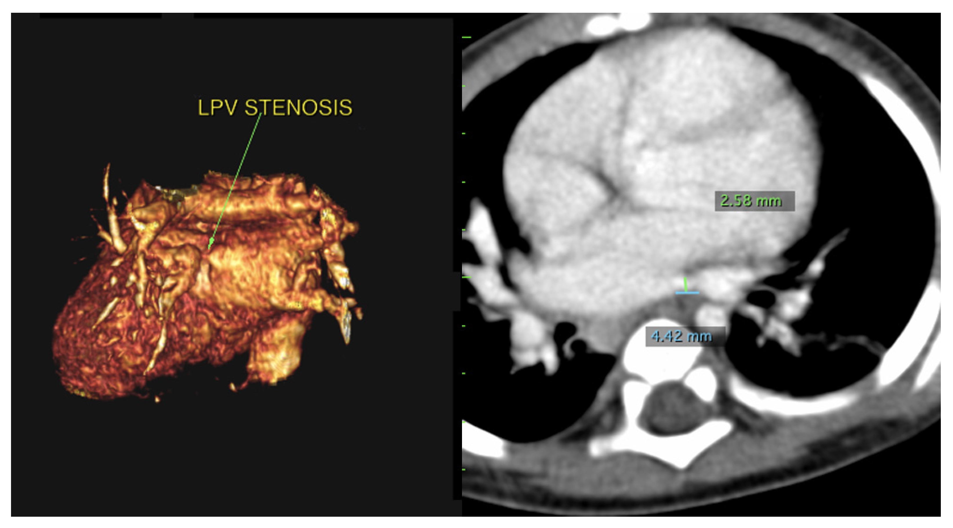 Children 08 00198 g003