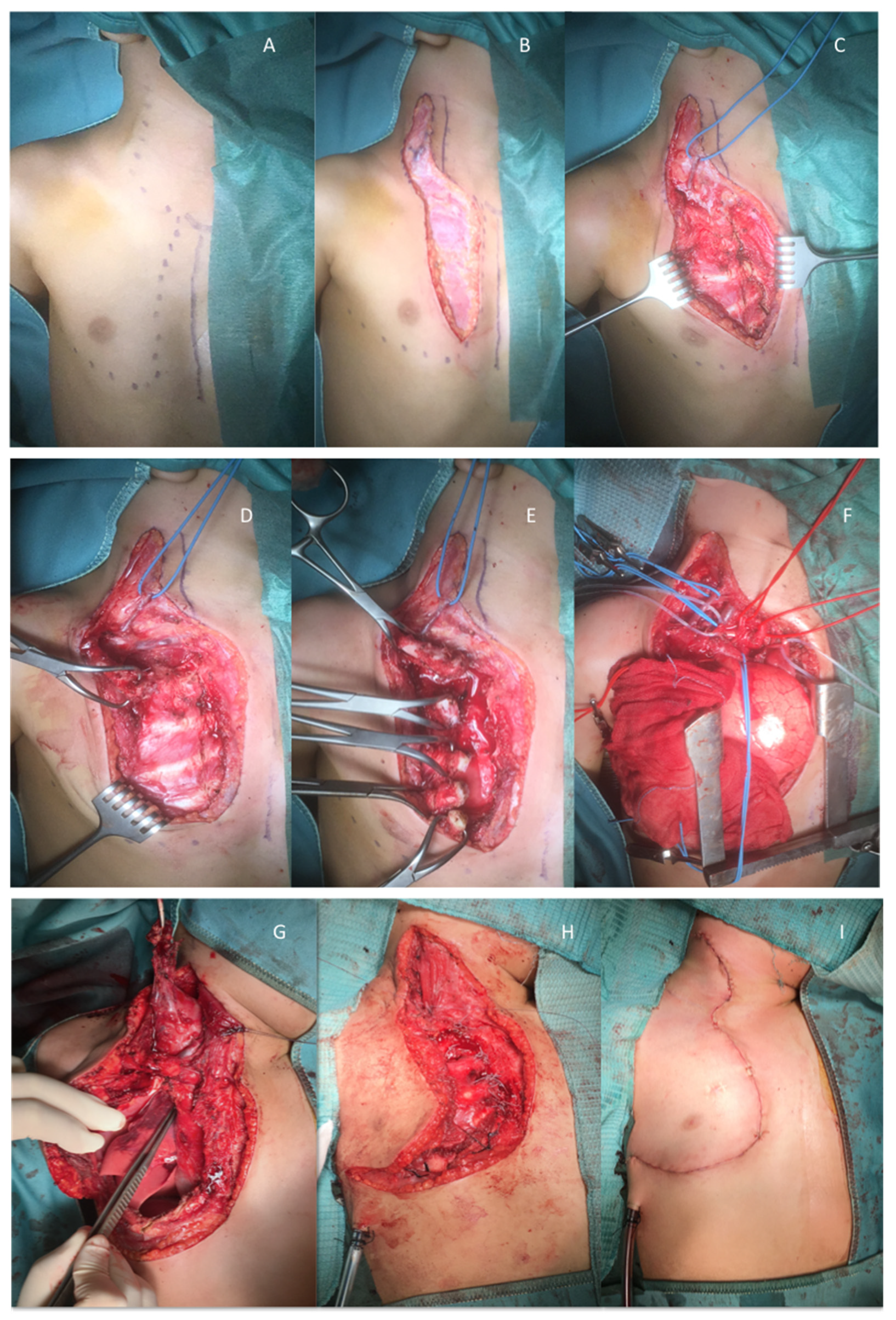 Children 08 00229 g003