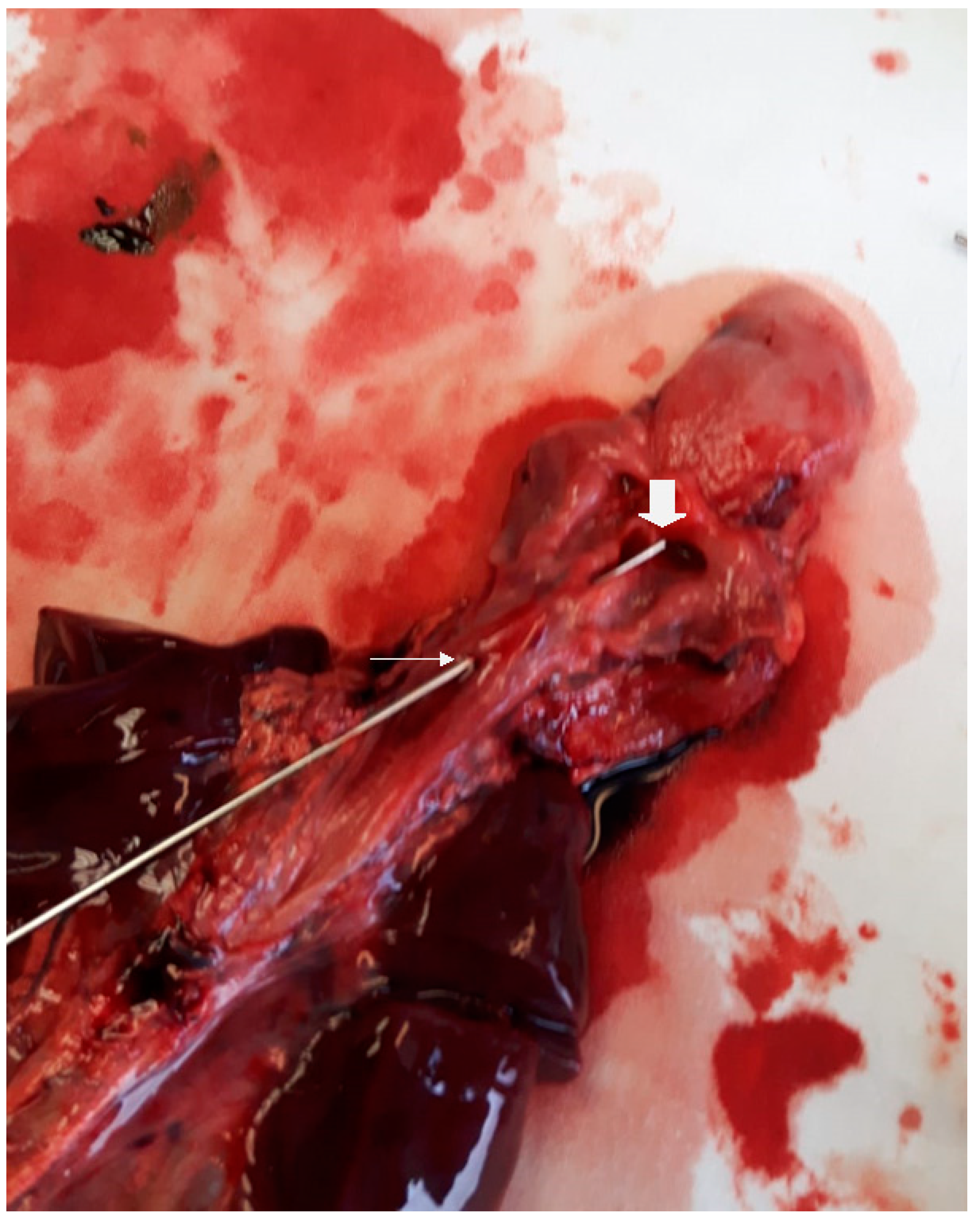 Children 08 00255 g003