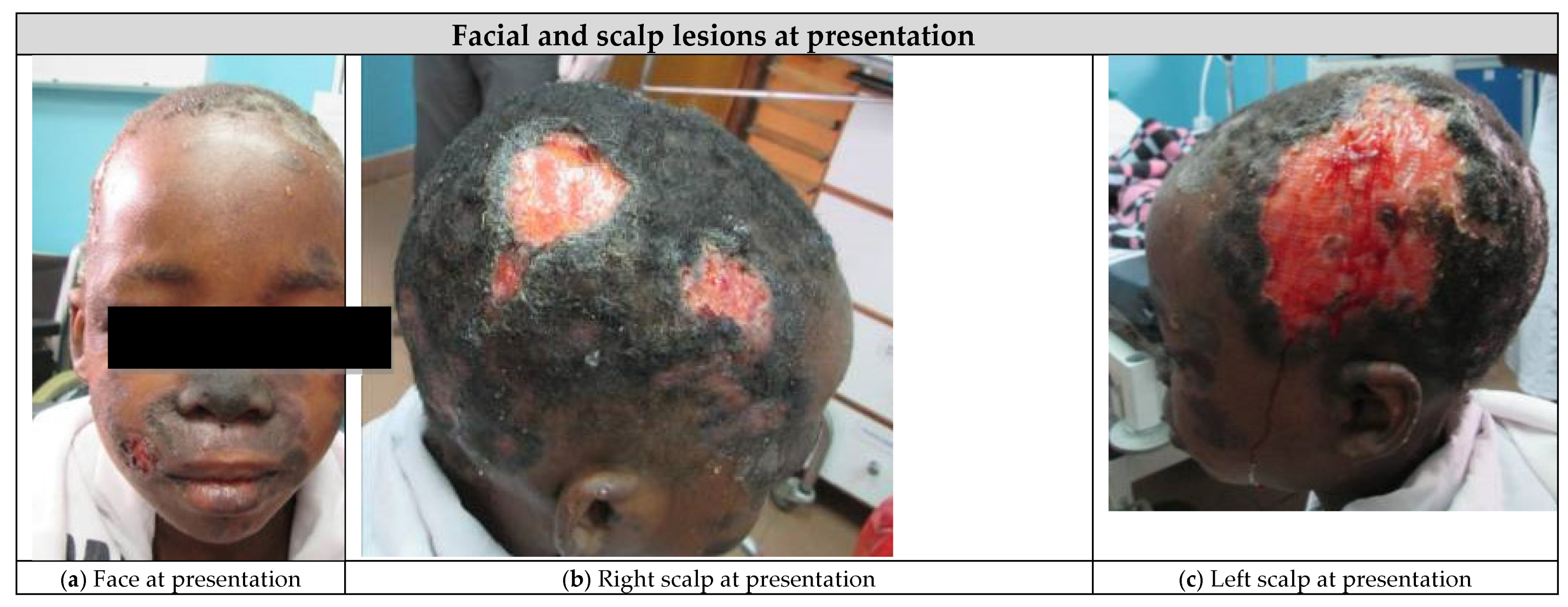 Children 08 00273 g001a