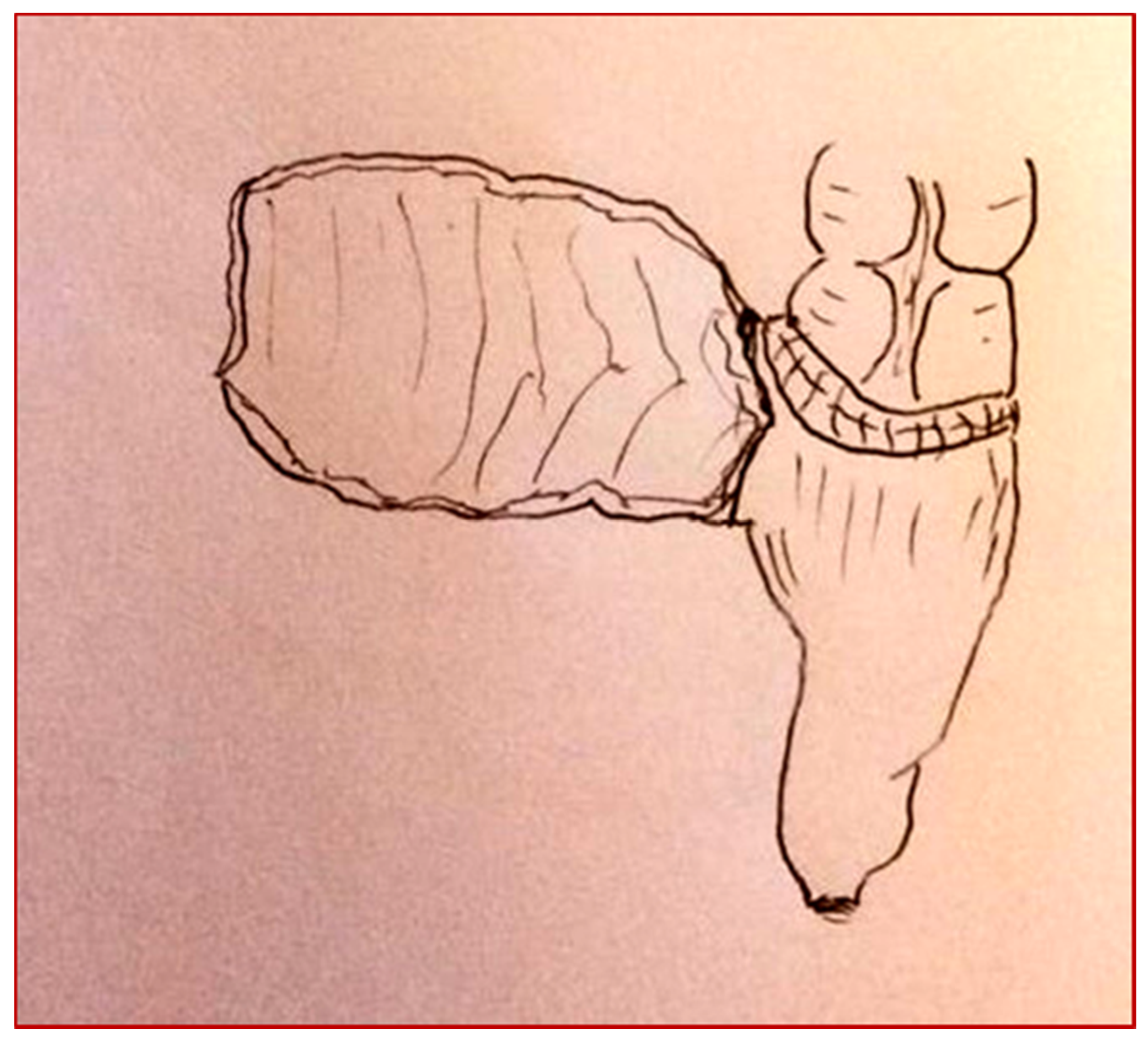 Children 08 00279 g005