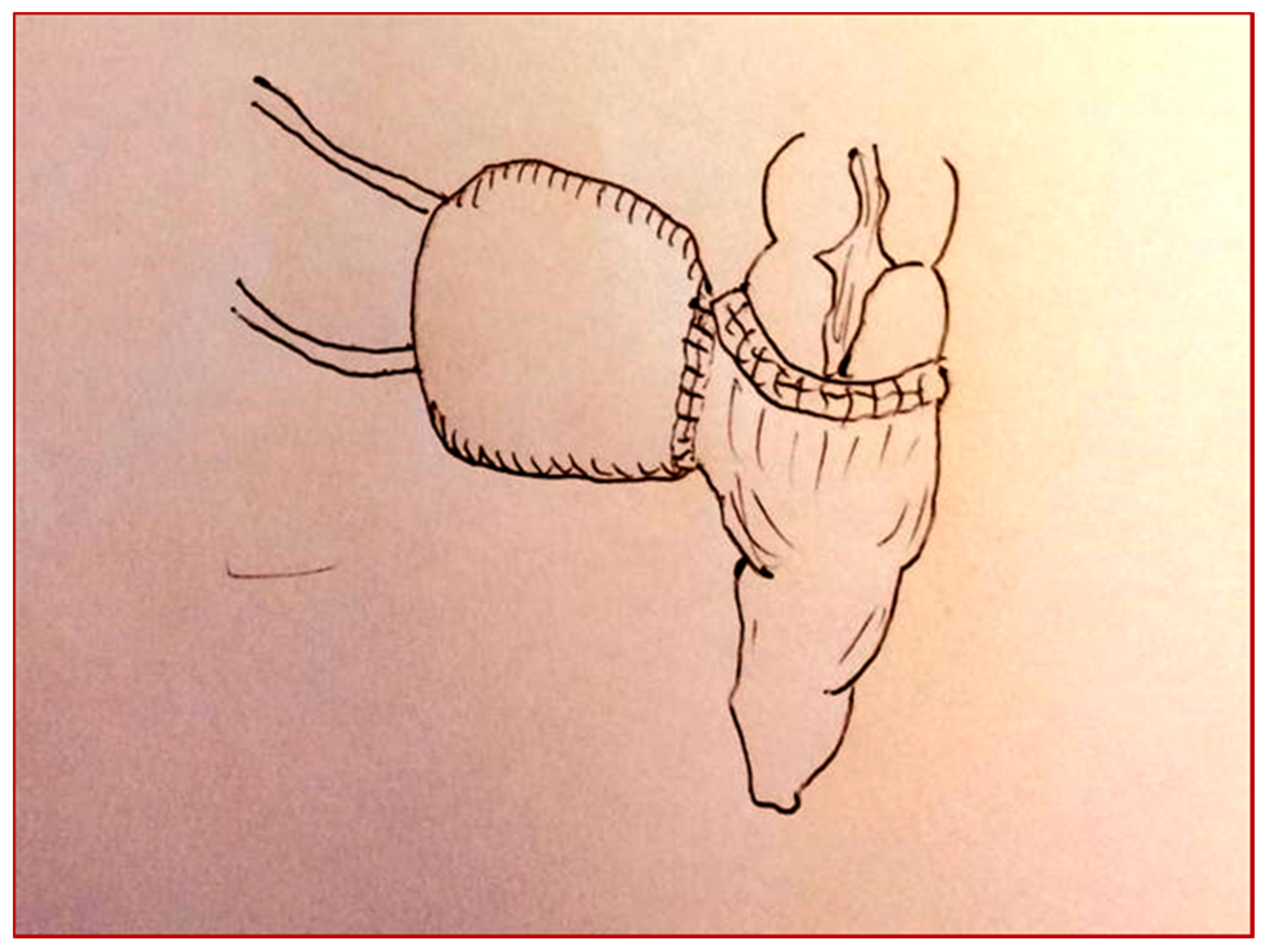 Children 08 00279 g007