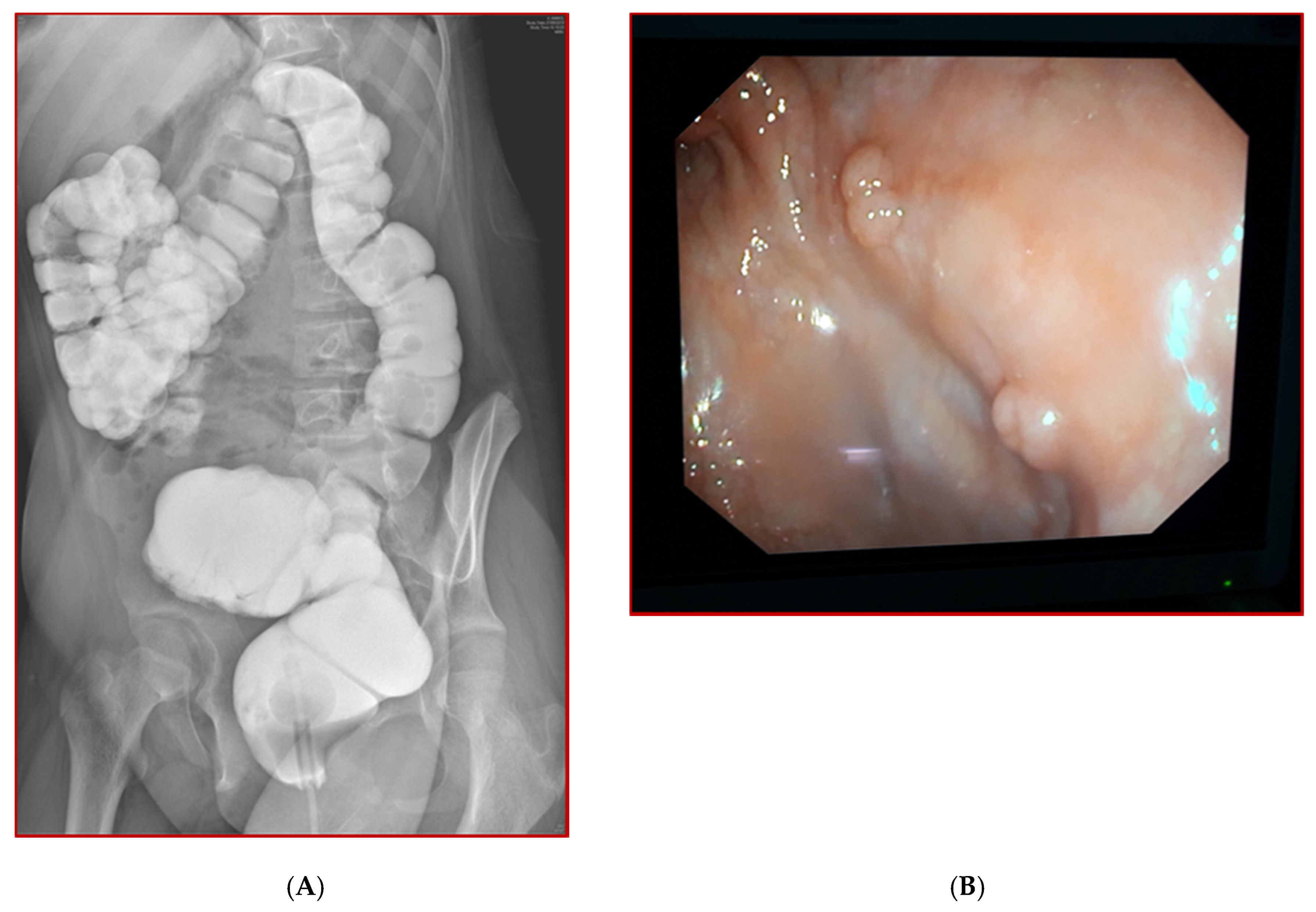 Children 08 00279 g008