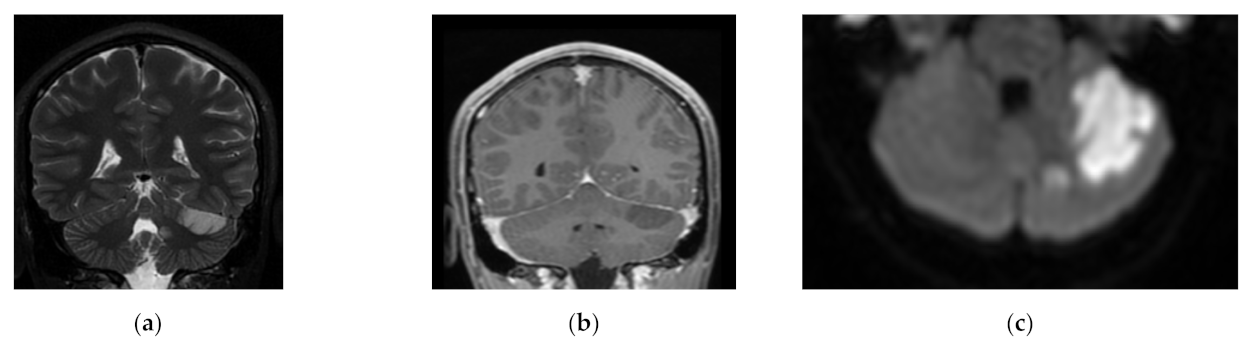 Children 08 00292 g003