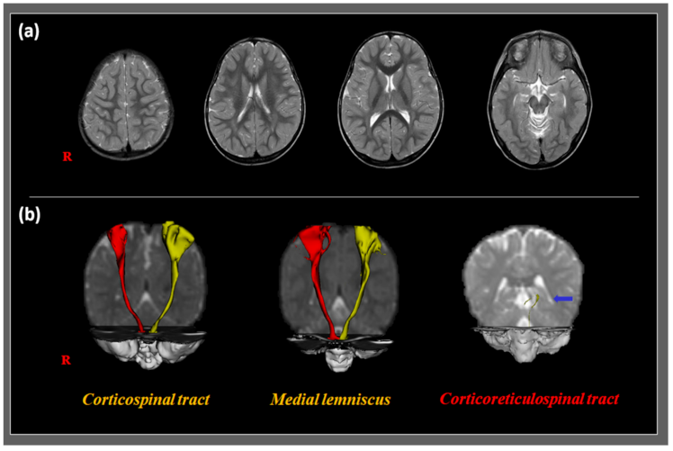 Children 08 00320 g001