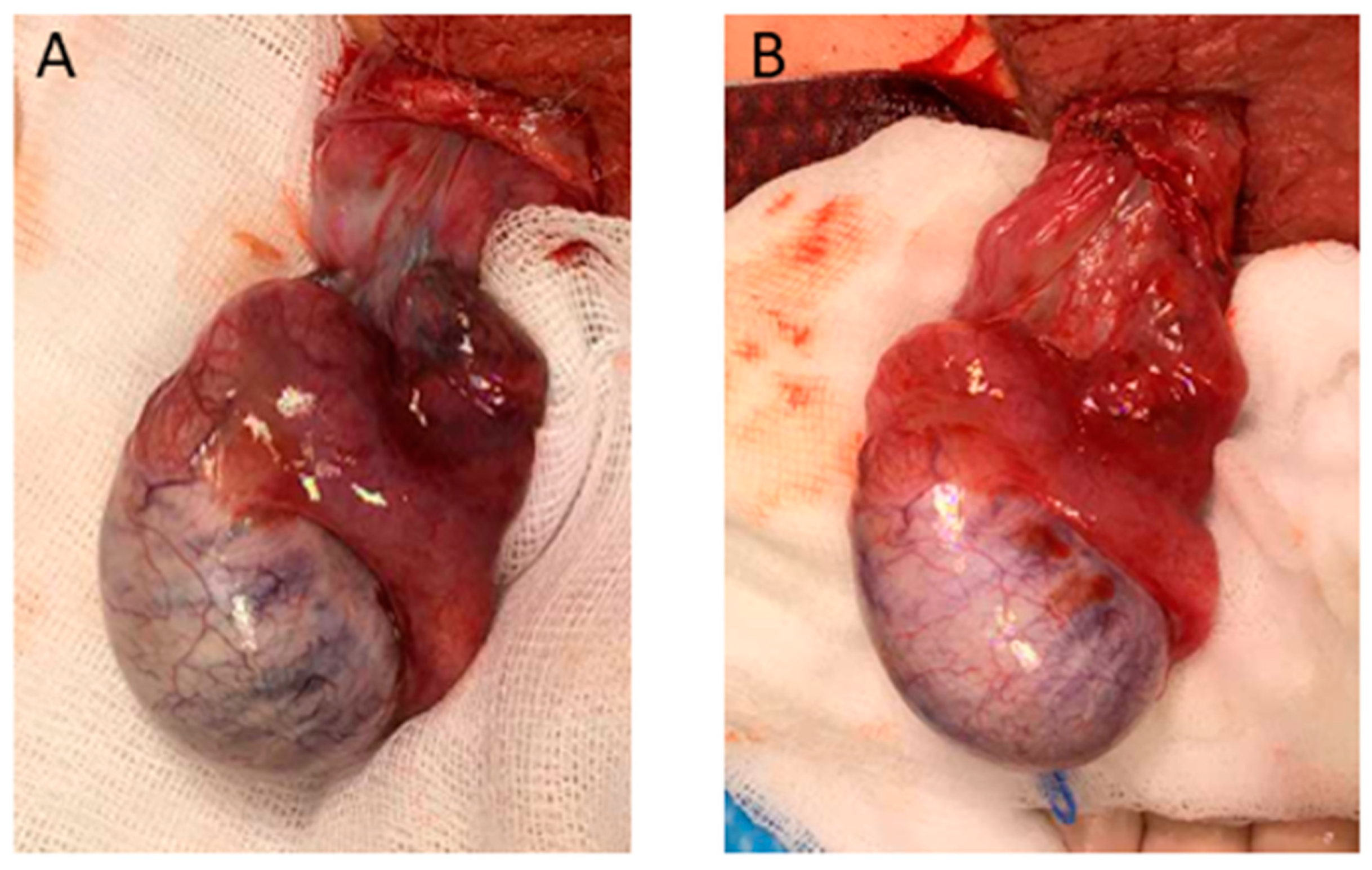 Children 08 00429 g002