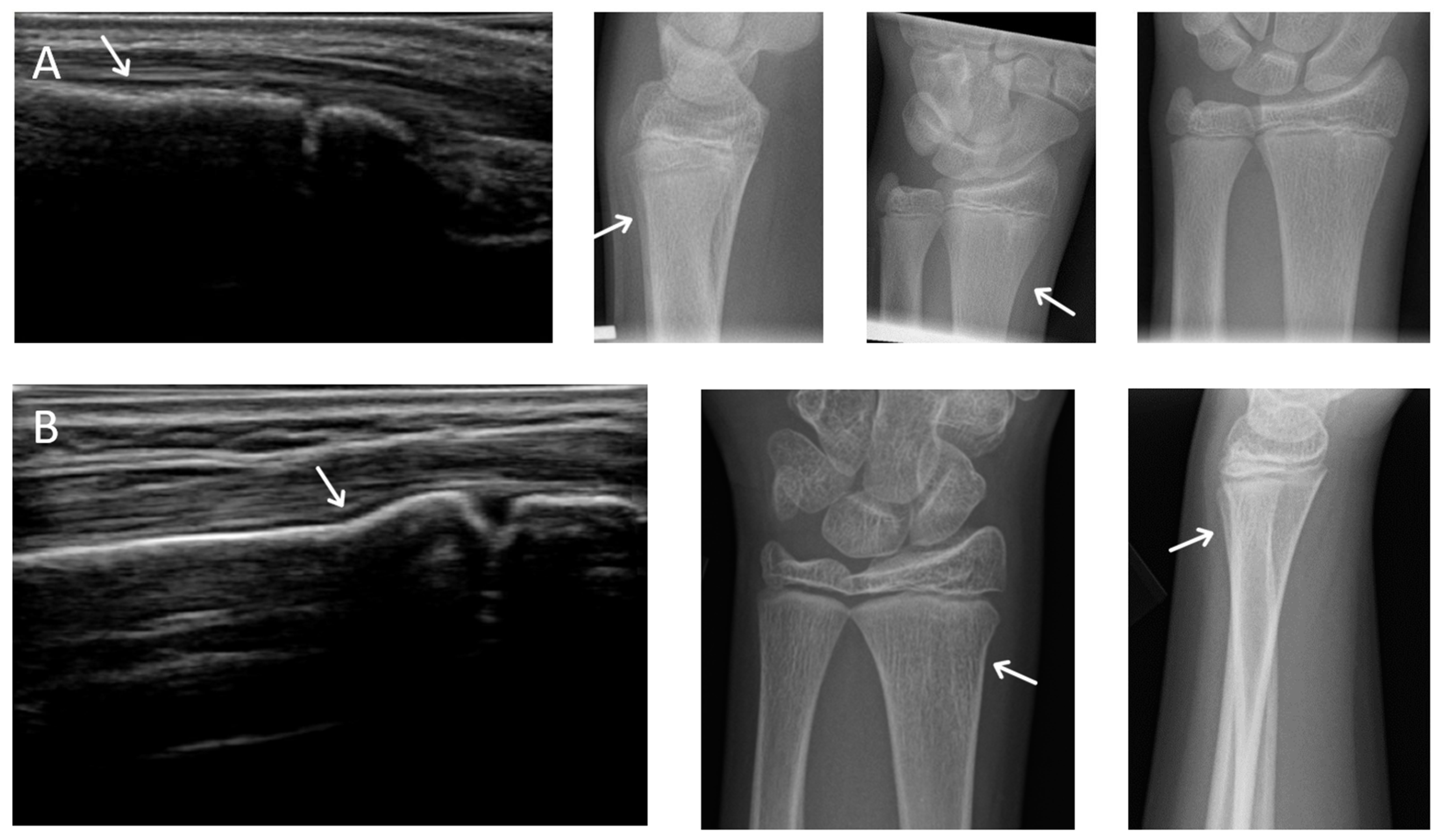 Children 08 00431 g001