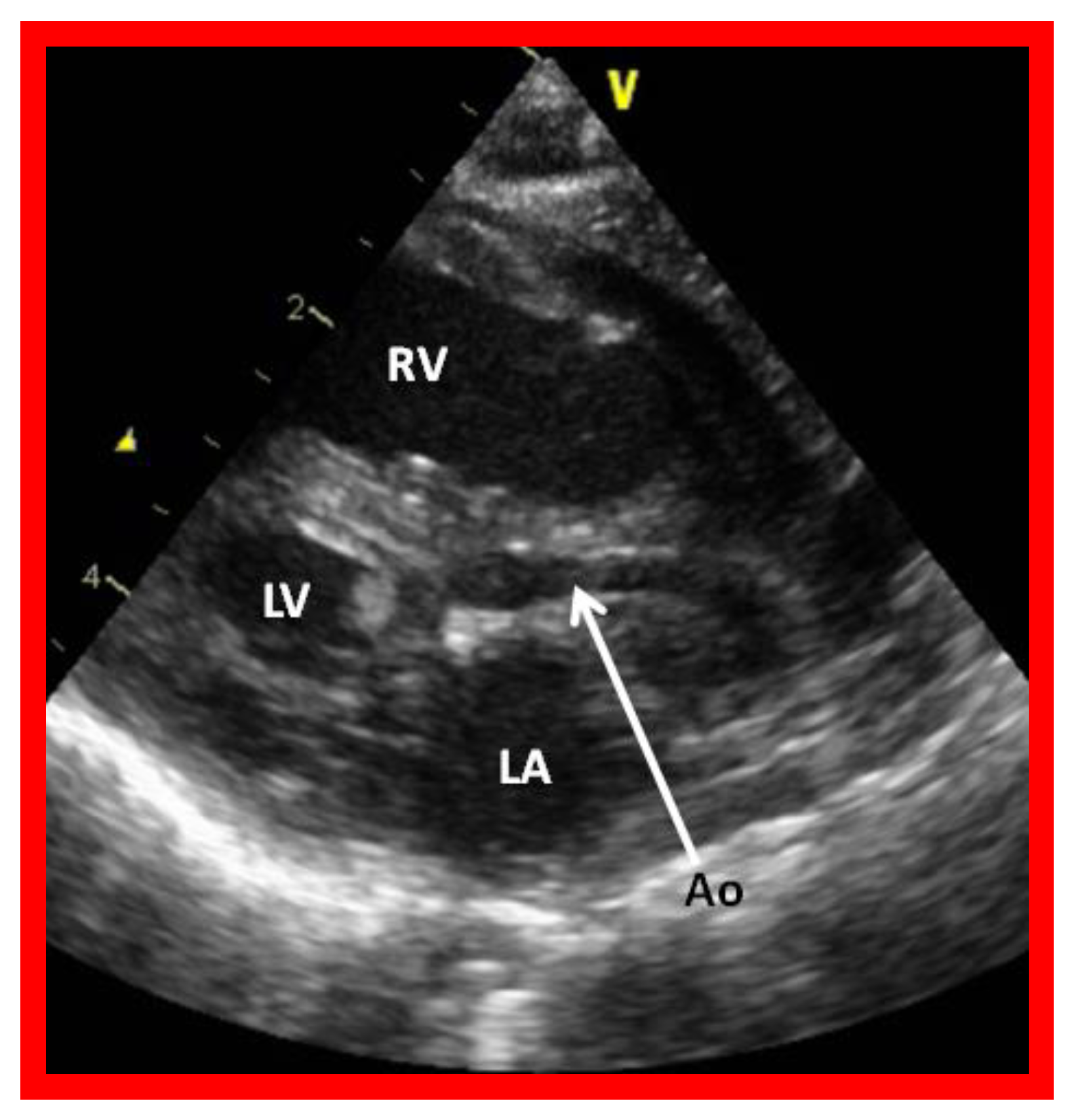 Children 08 00441 g002