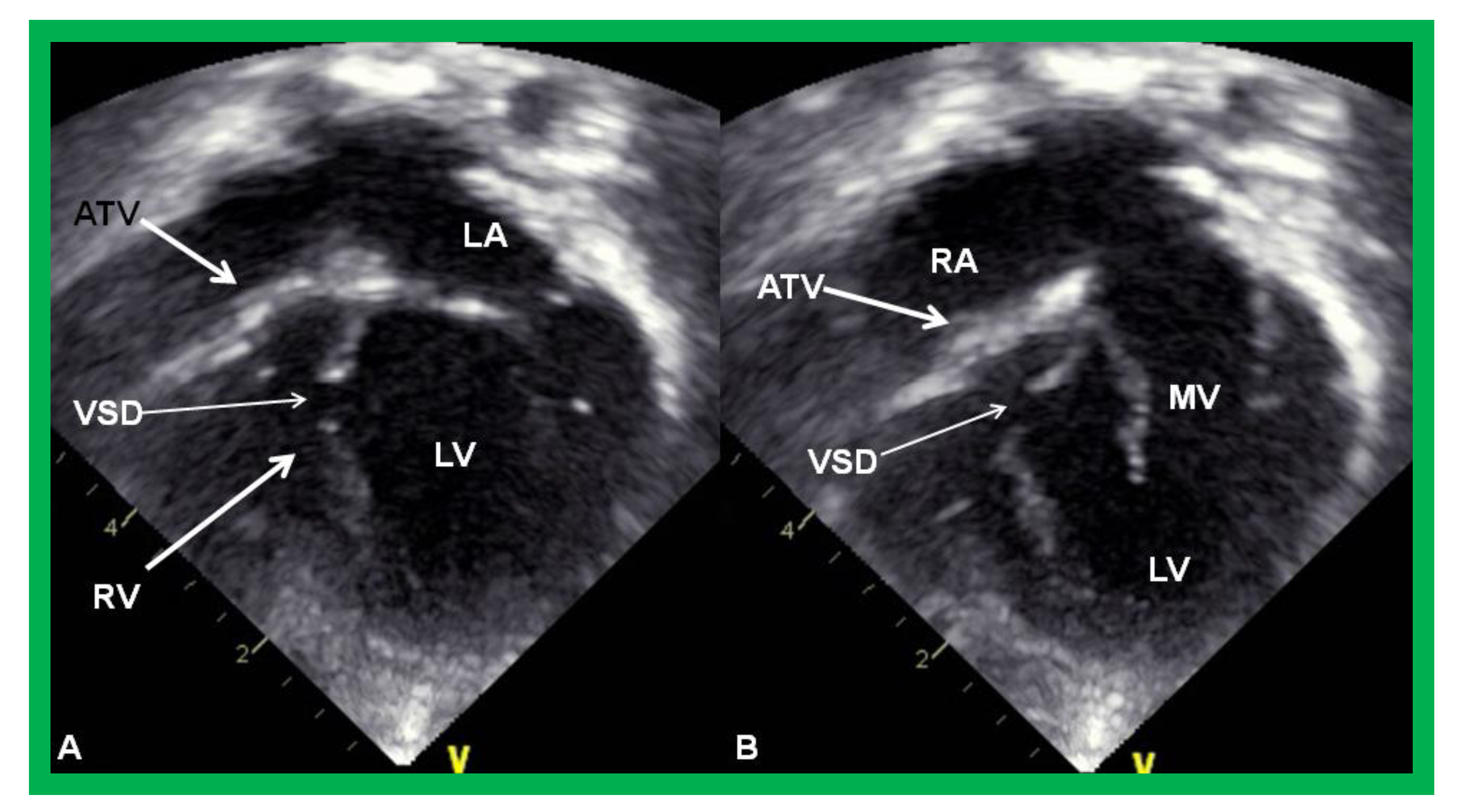 Children 08 00441 g003