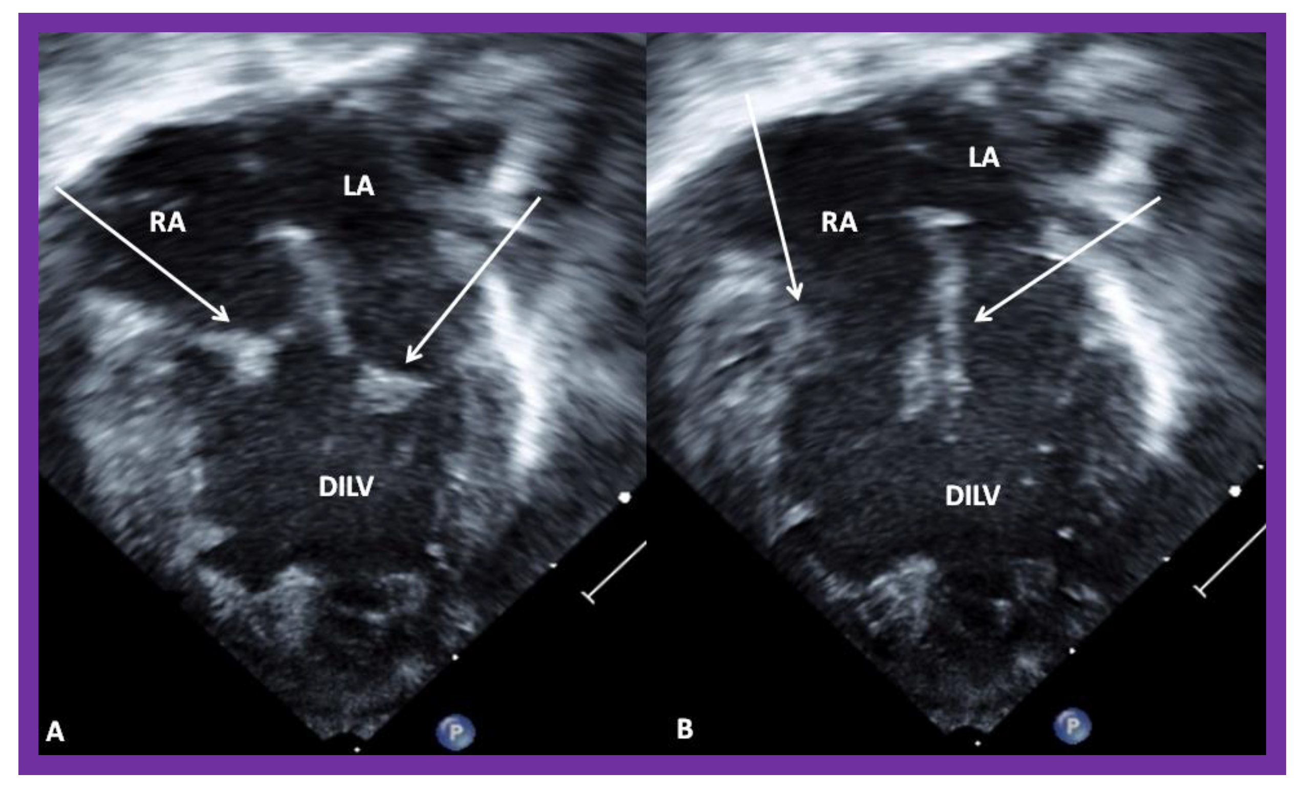 Children 08 00441 g004