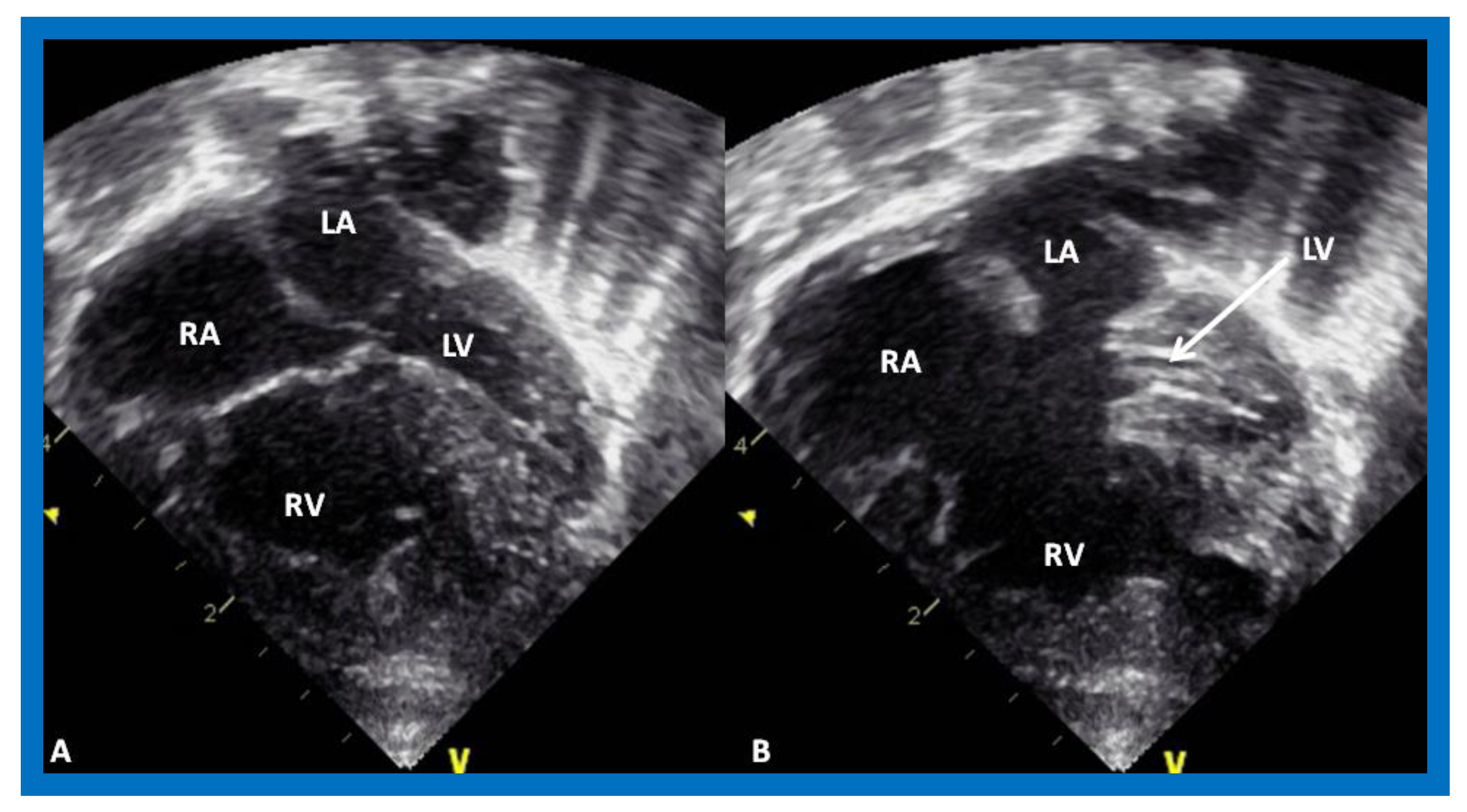 Children 08 00441 g005