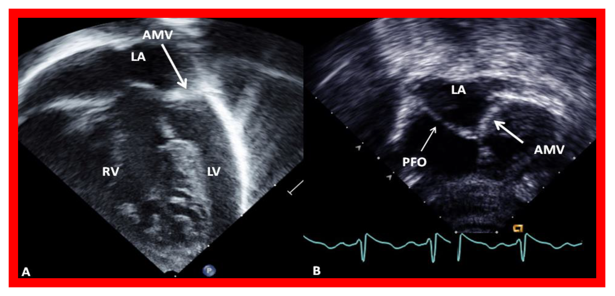 Children 08 00441 g006