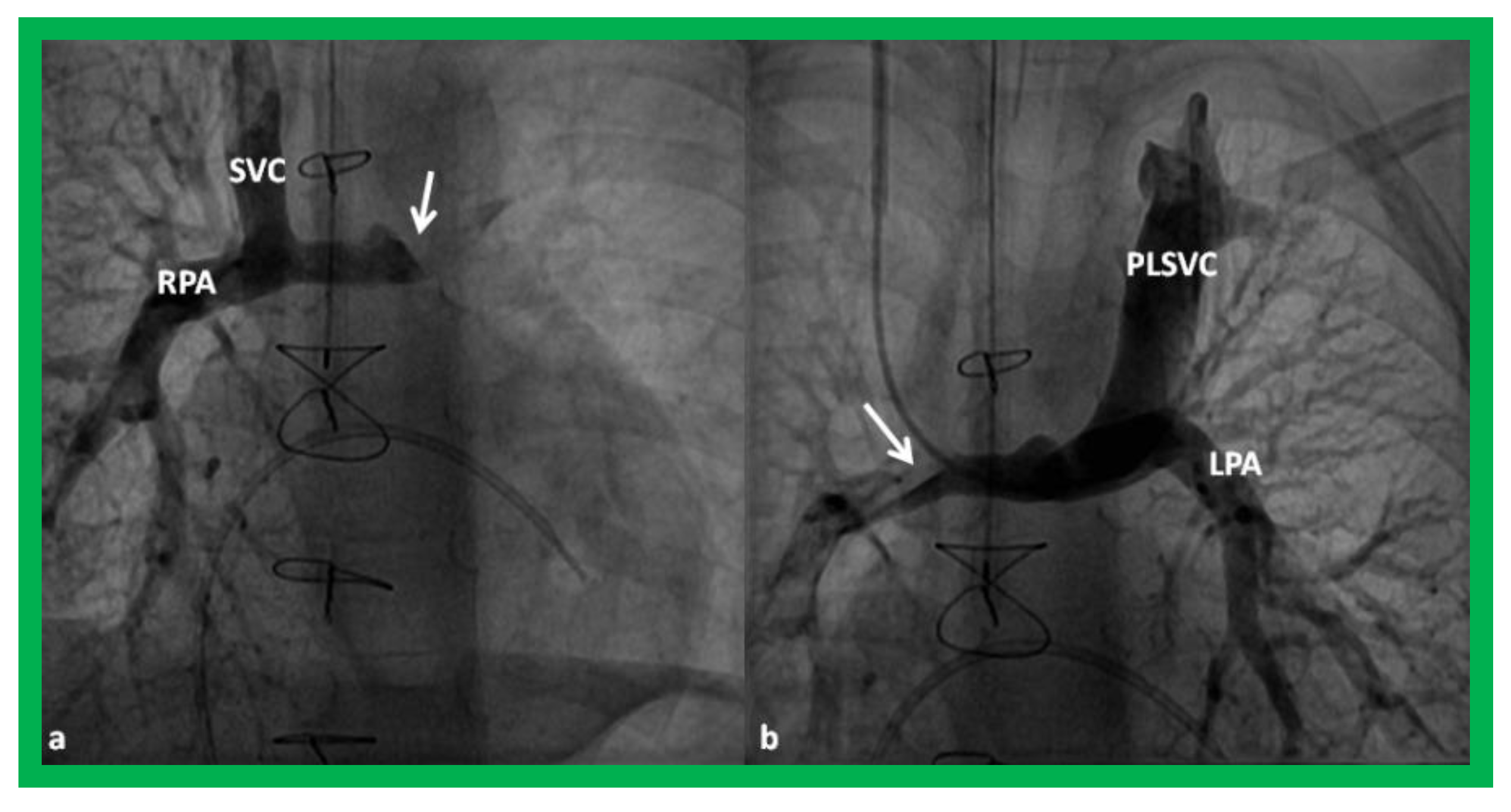 Children 08 00441 g015