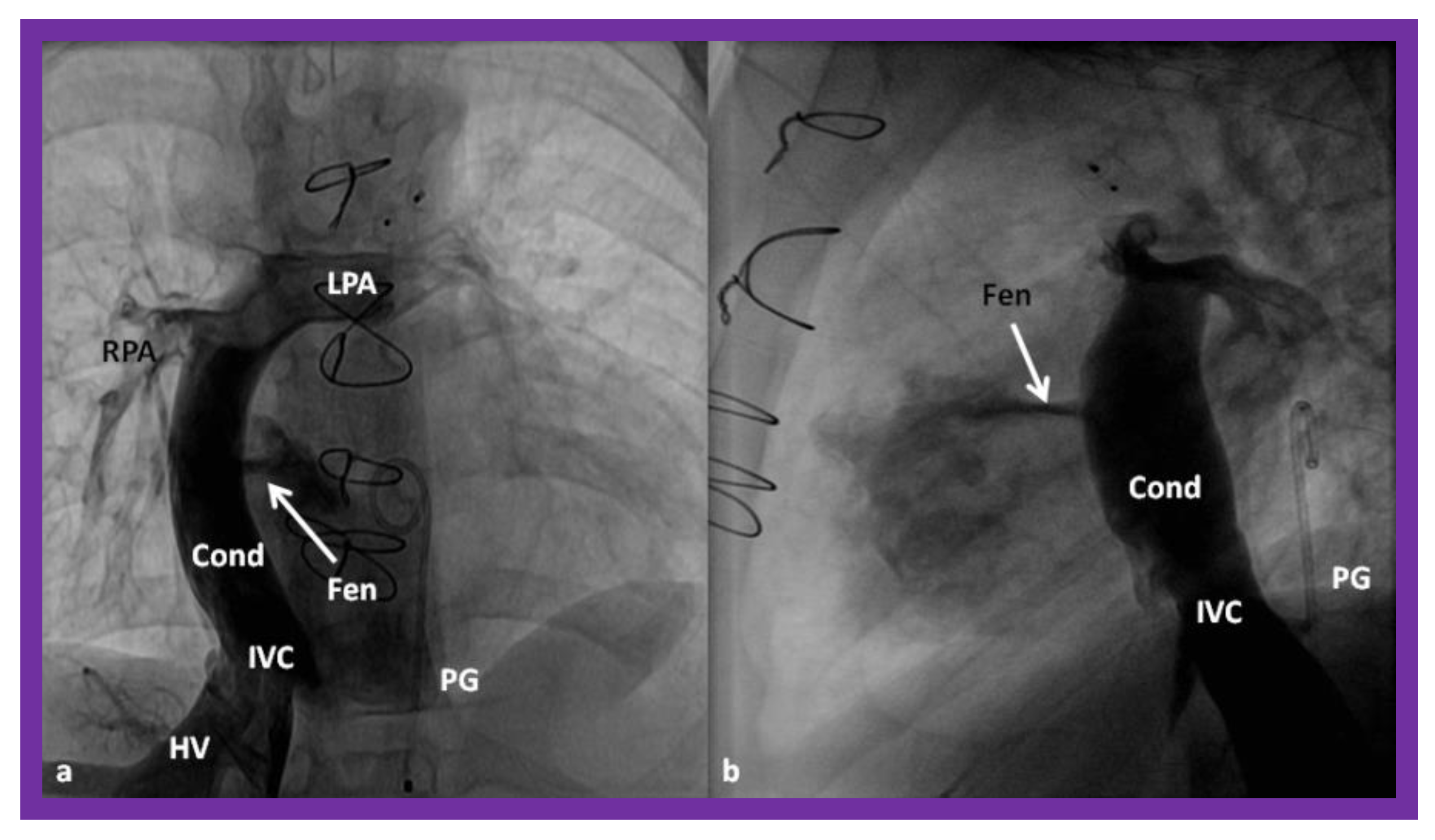 Children 08 00441 g016