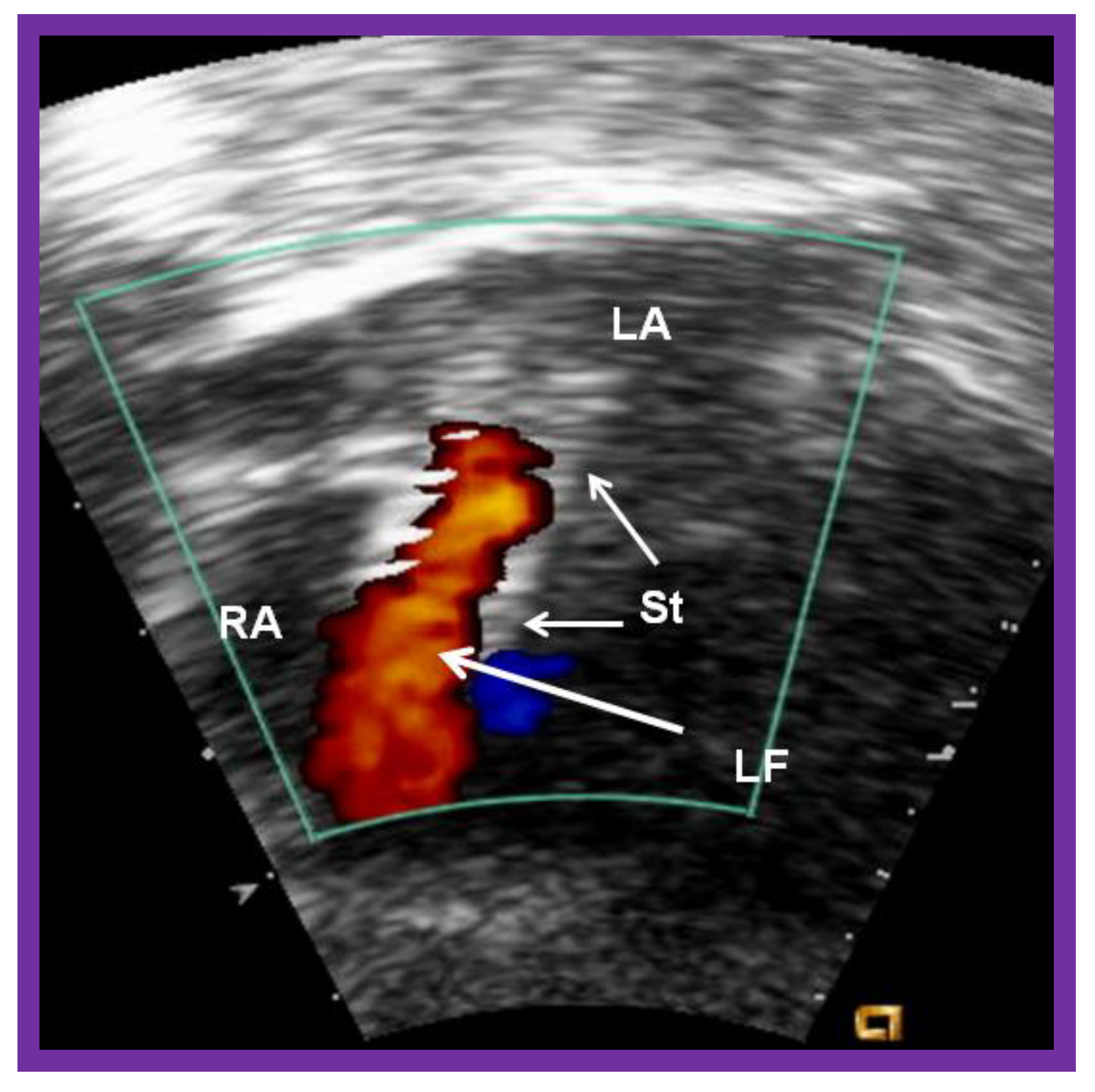 Children 08 00441 g020