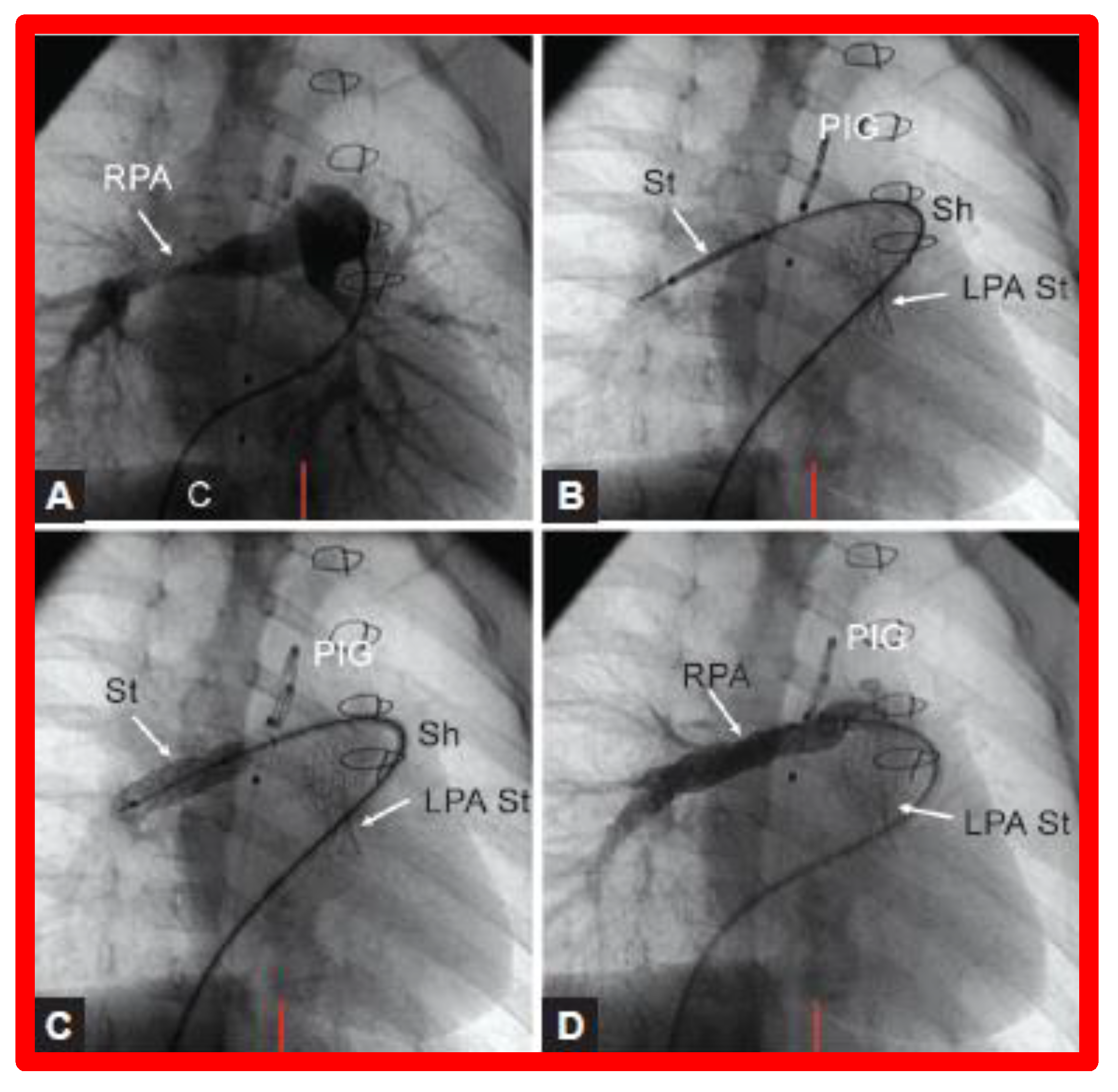 Children 08 00441 g026