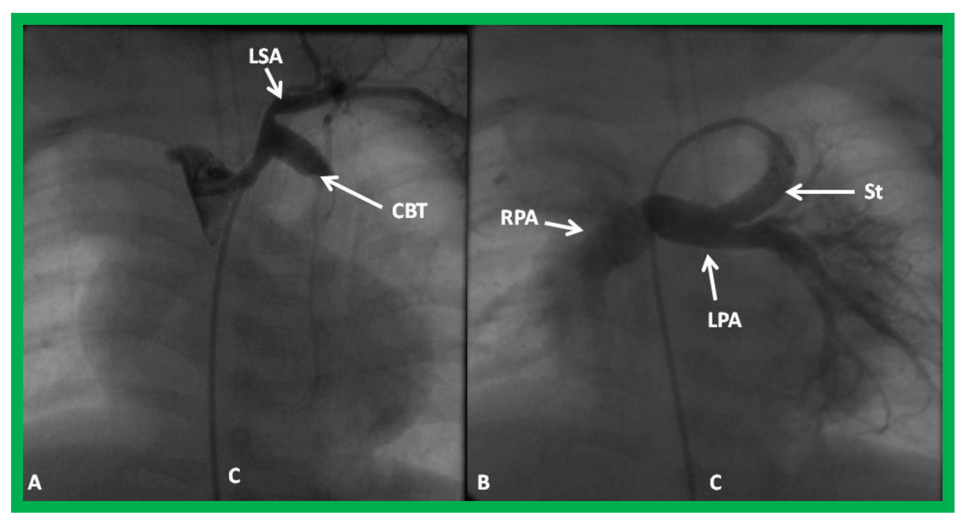 Children 08 00441 g027