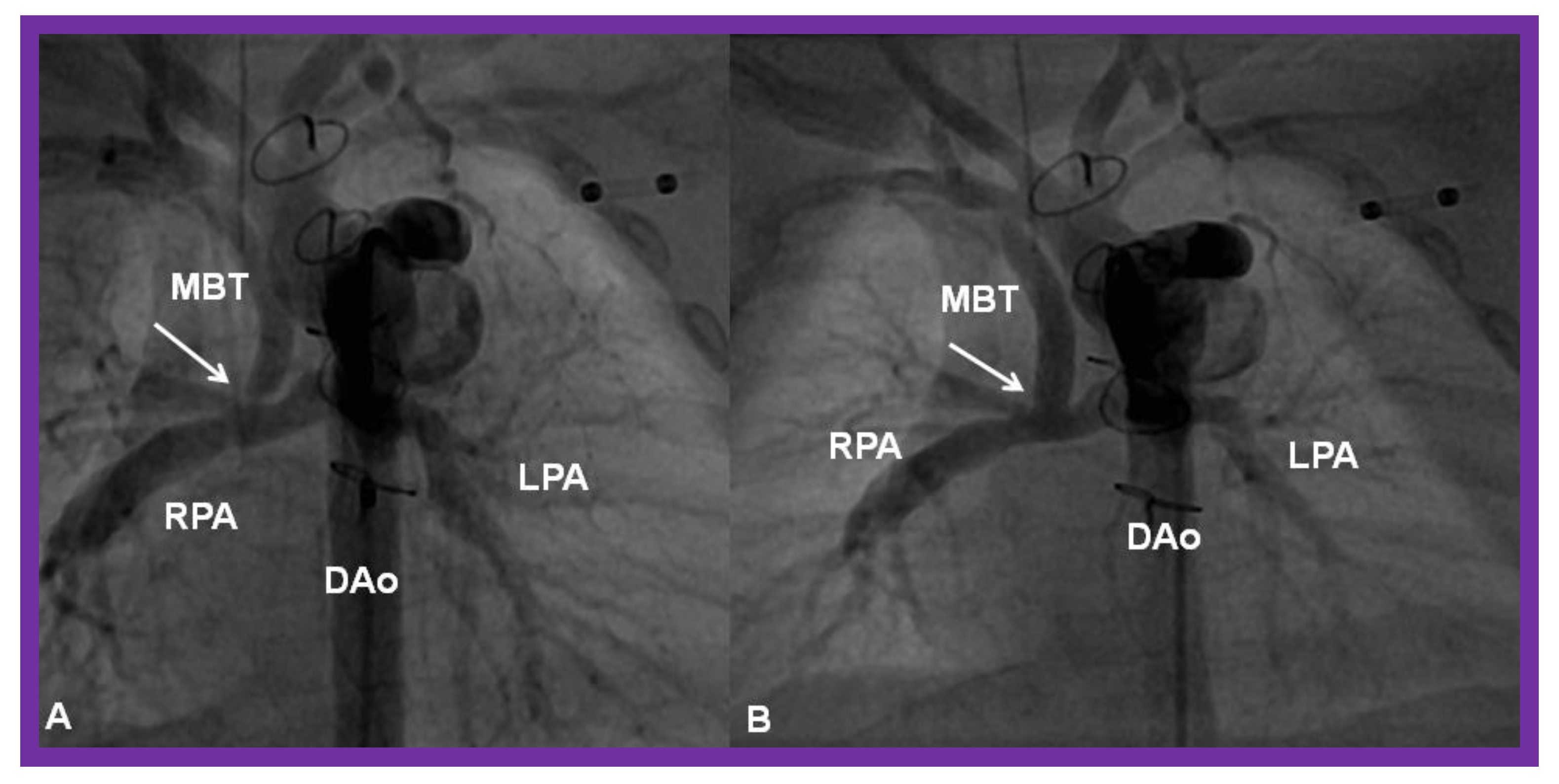 Children 08 00441 g028