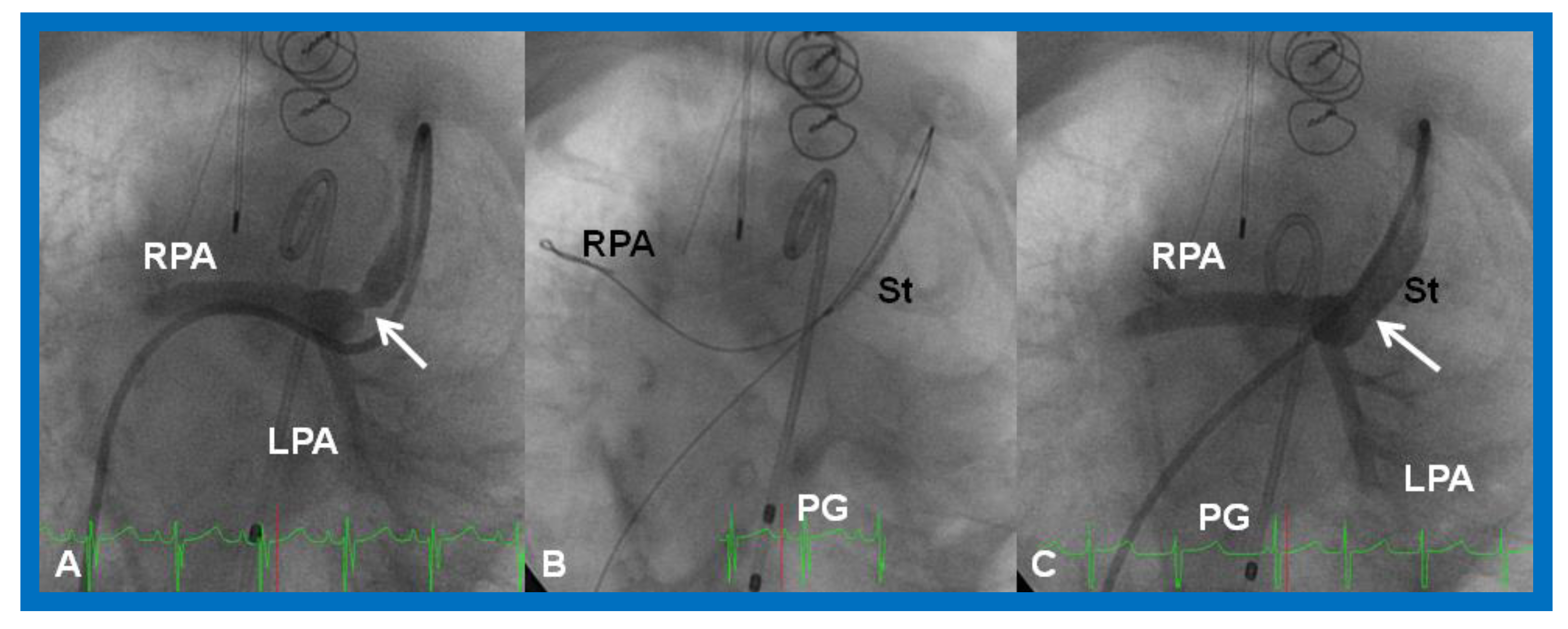 Children 08 00441 g029