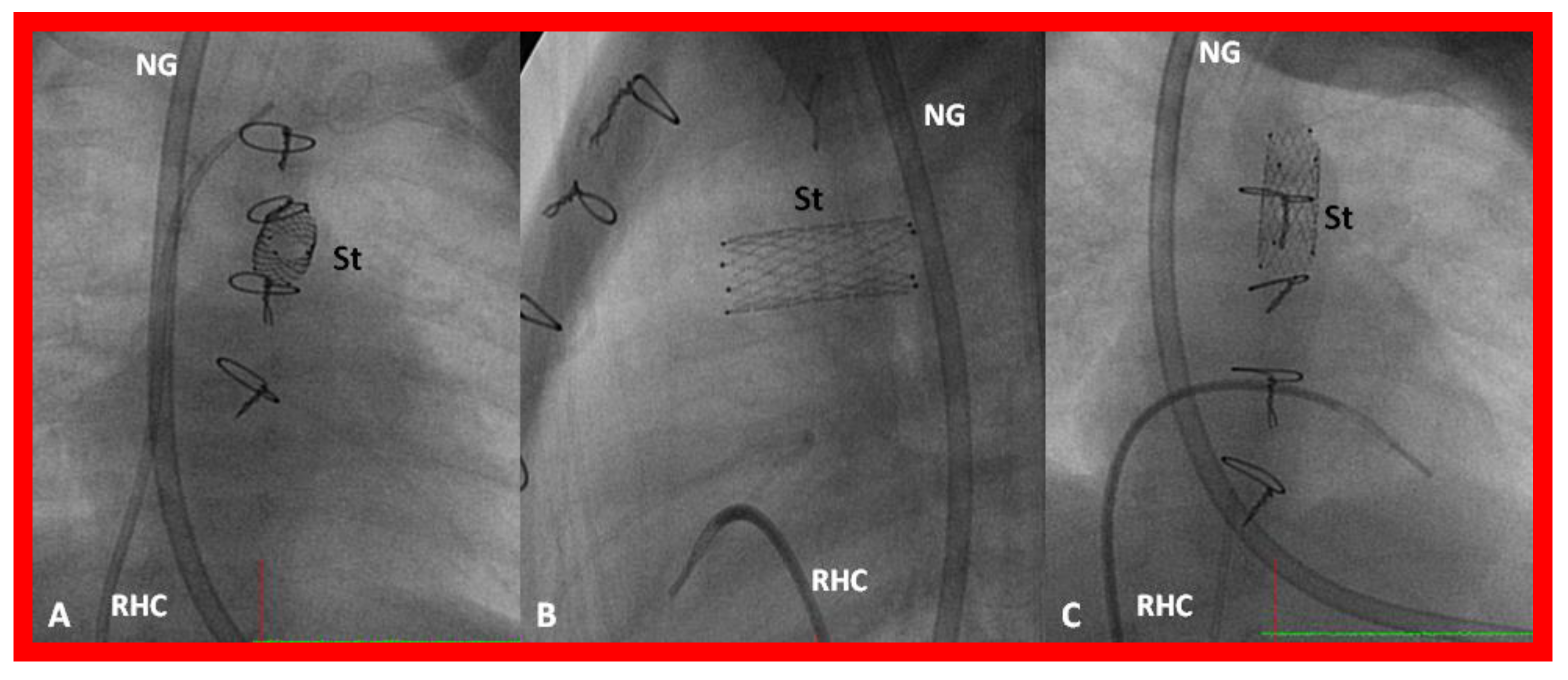 Children 08 00441 g030