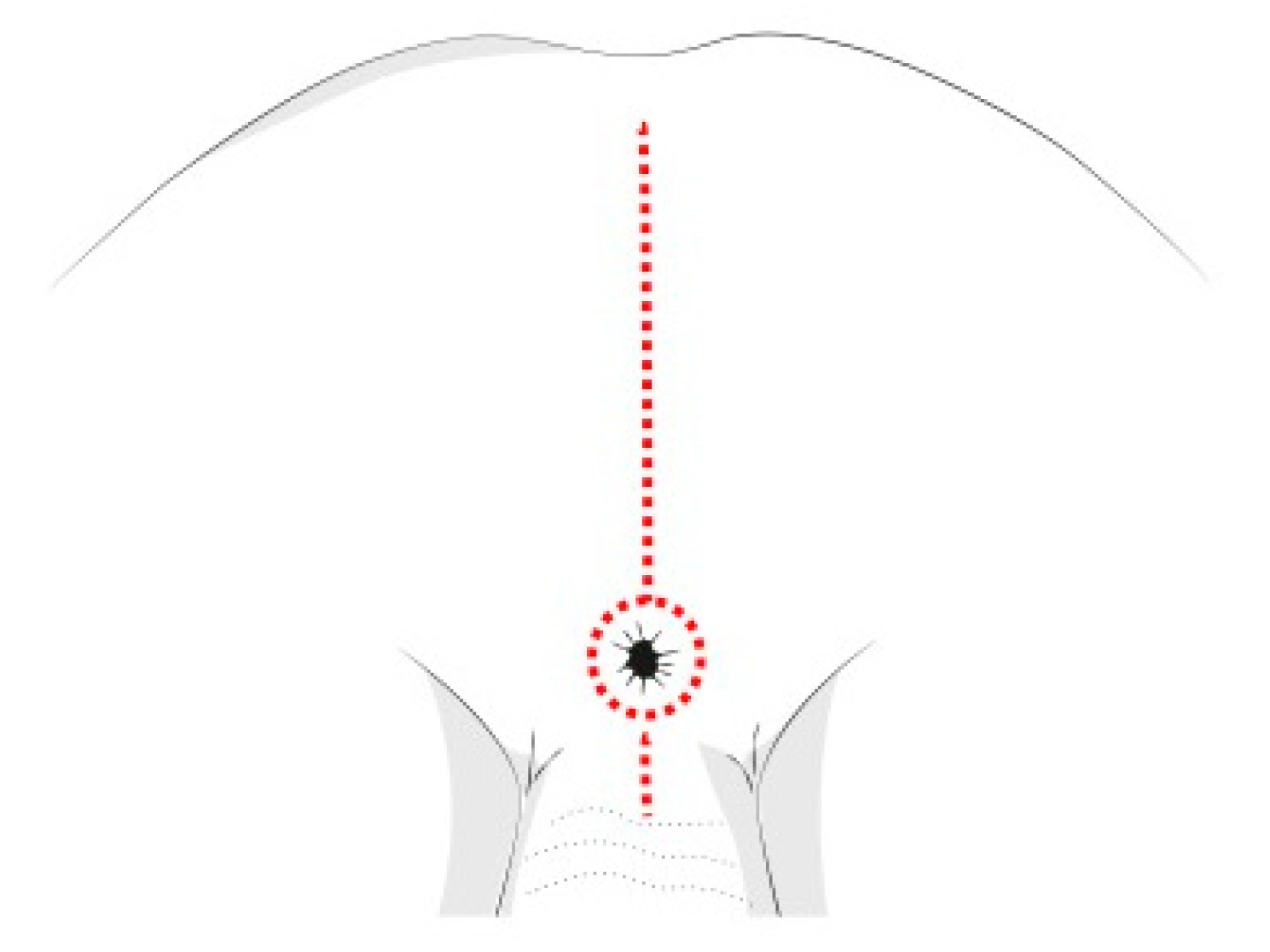 Children 08 00446 g006