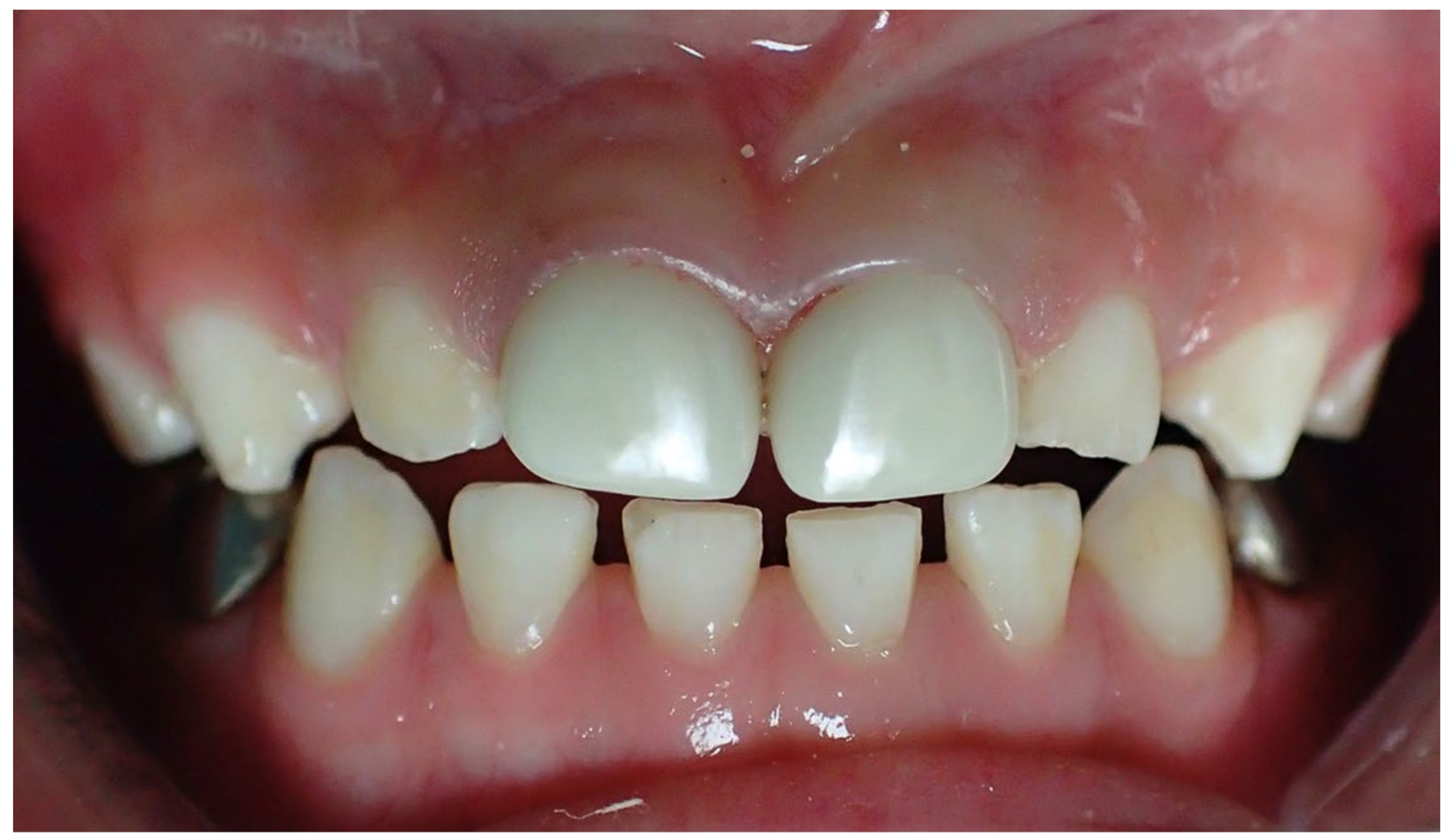 Children 08 00451 g002