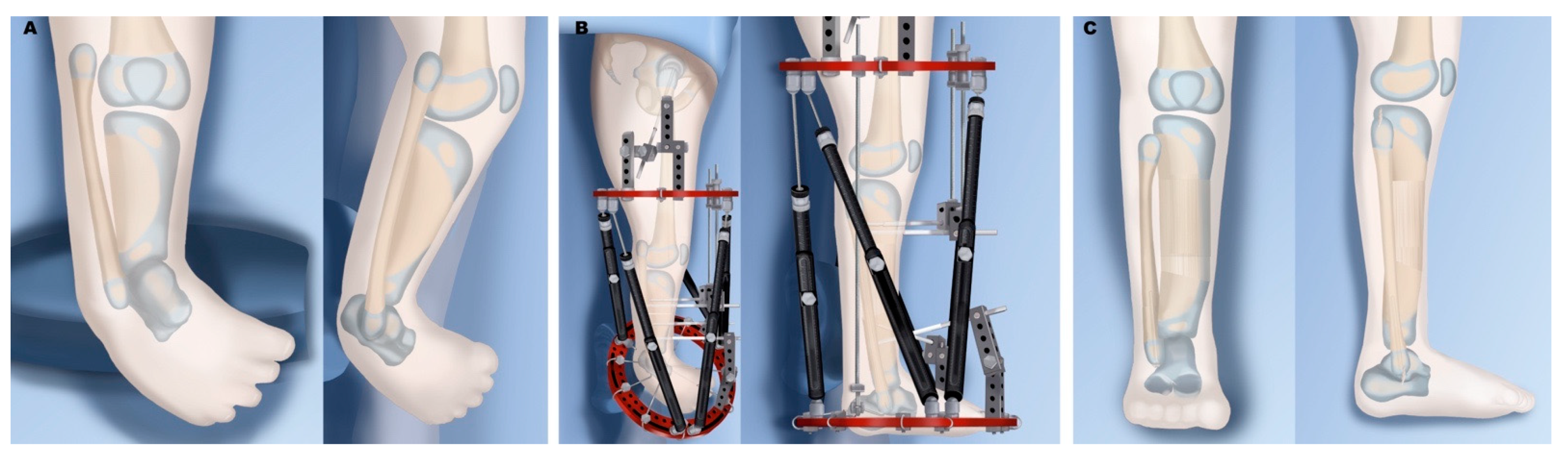 Children 08 00461 g004