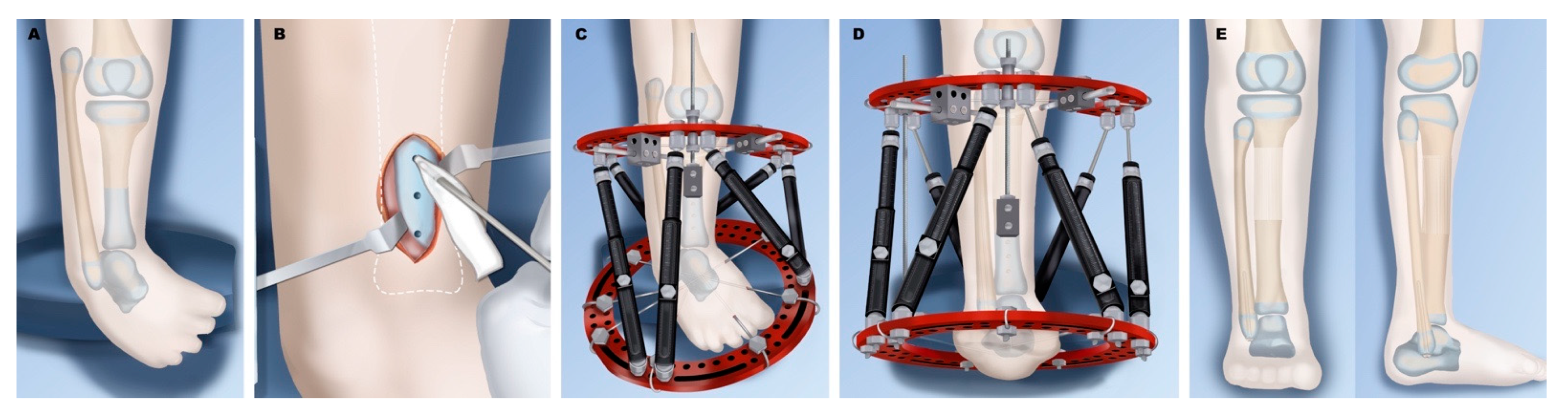 Children 08 00461 g005