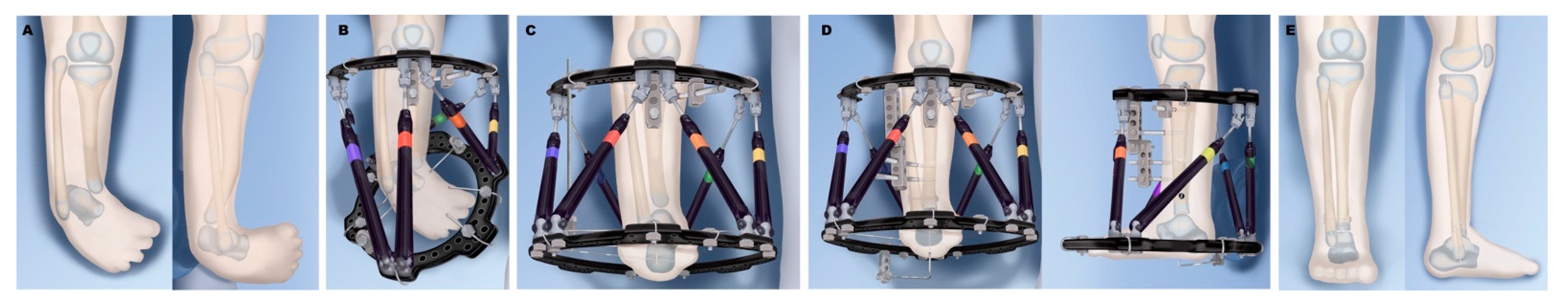 Children 08 00461 g006