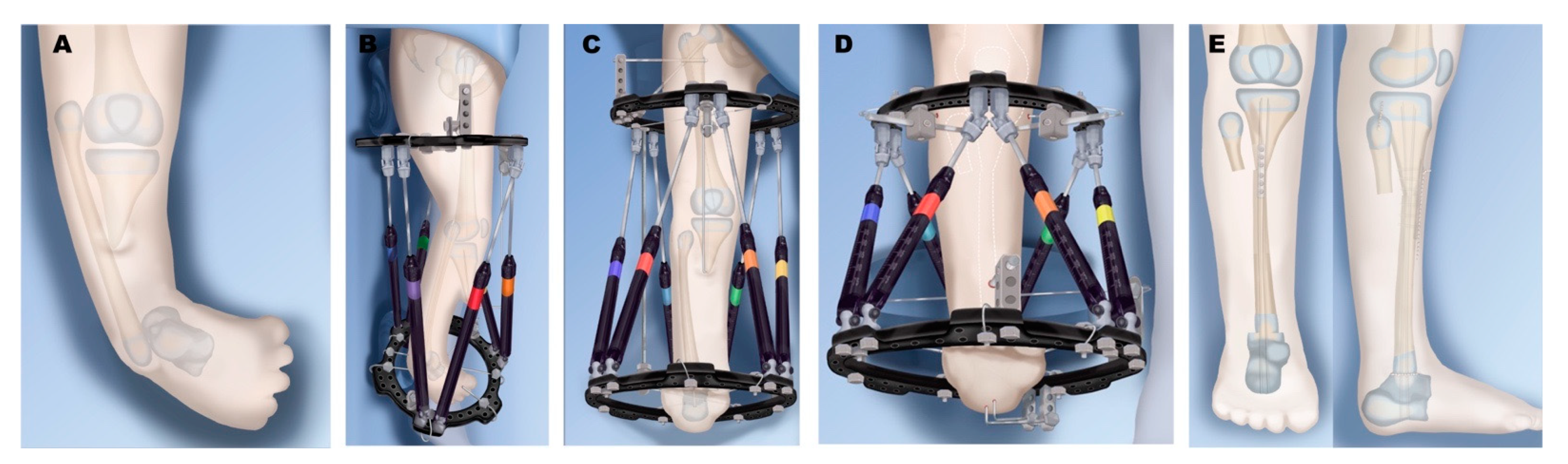 Children 08 00461 g008